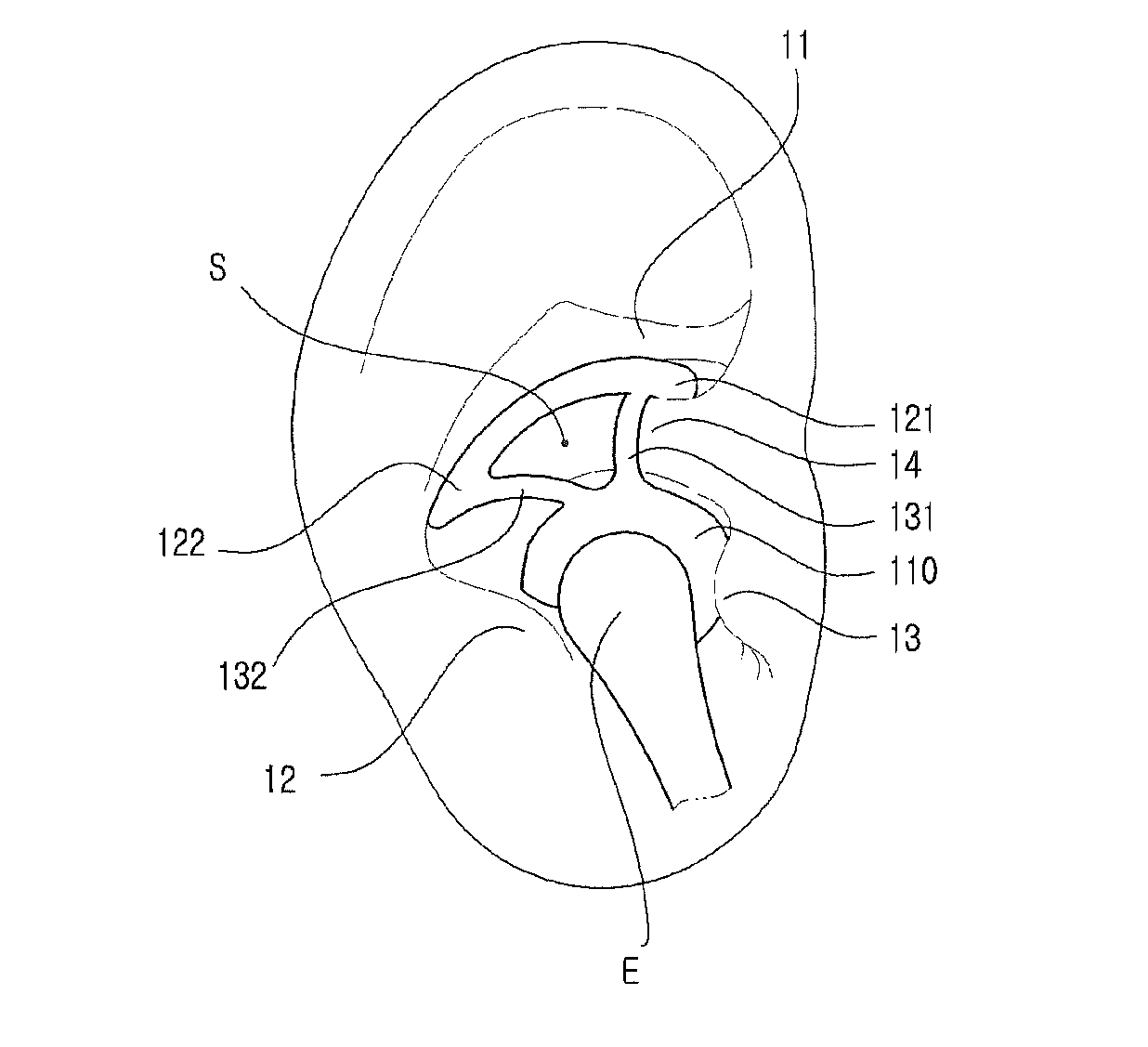 Ear-wing