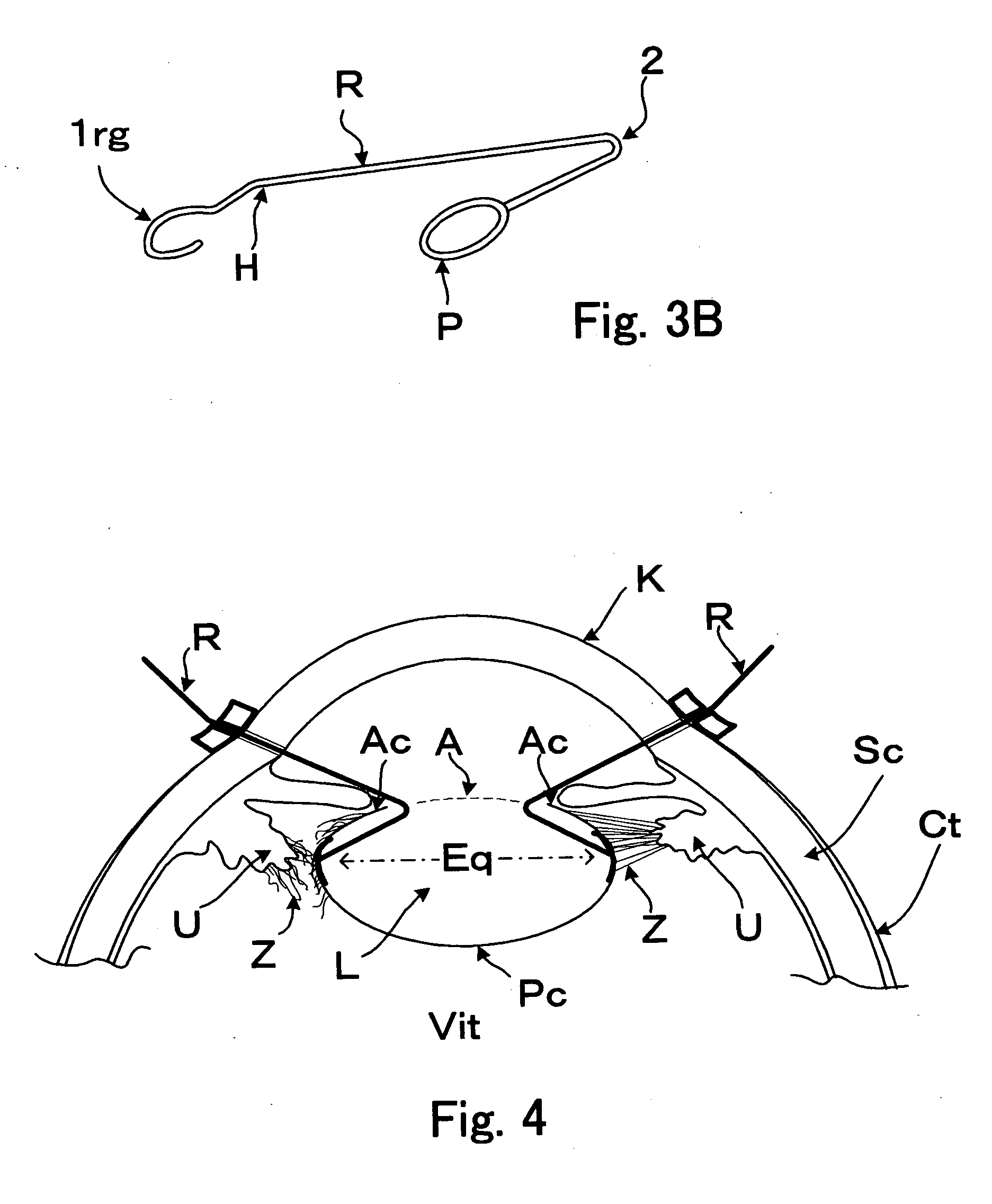 Intraocular device for retaining a lens capsule