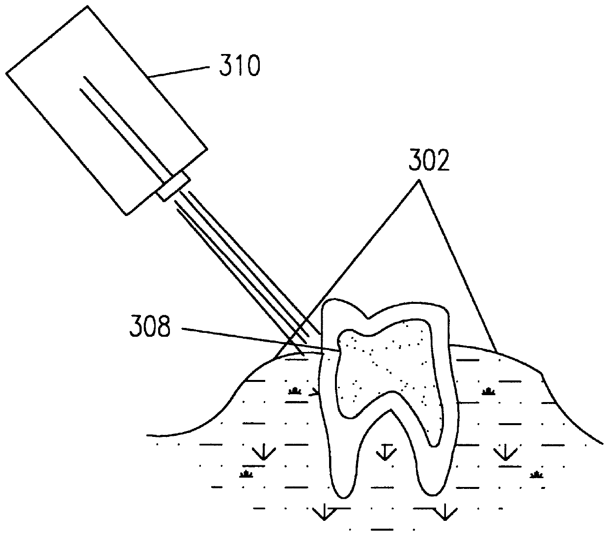 Device and method to treat oral disease in small animals