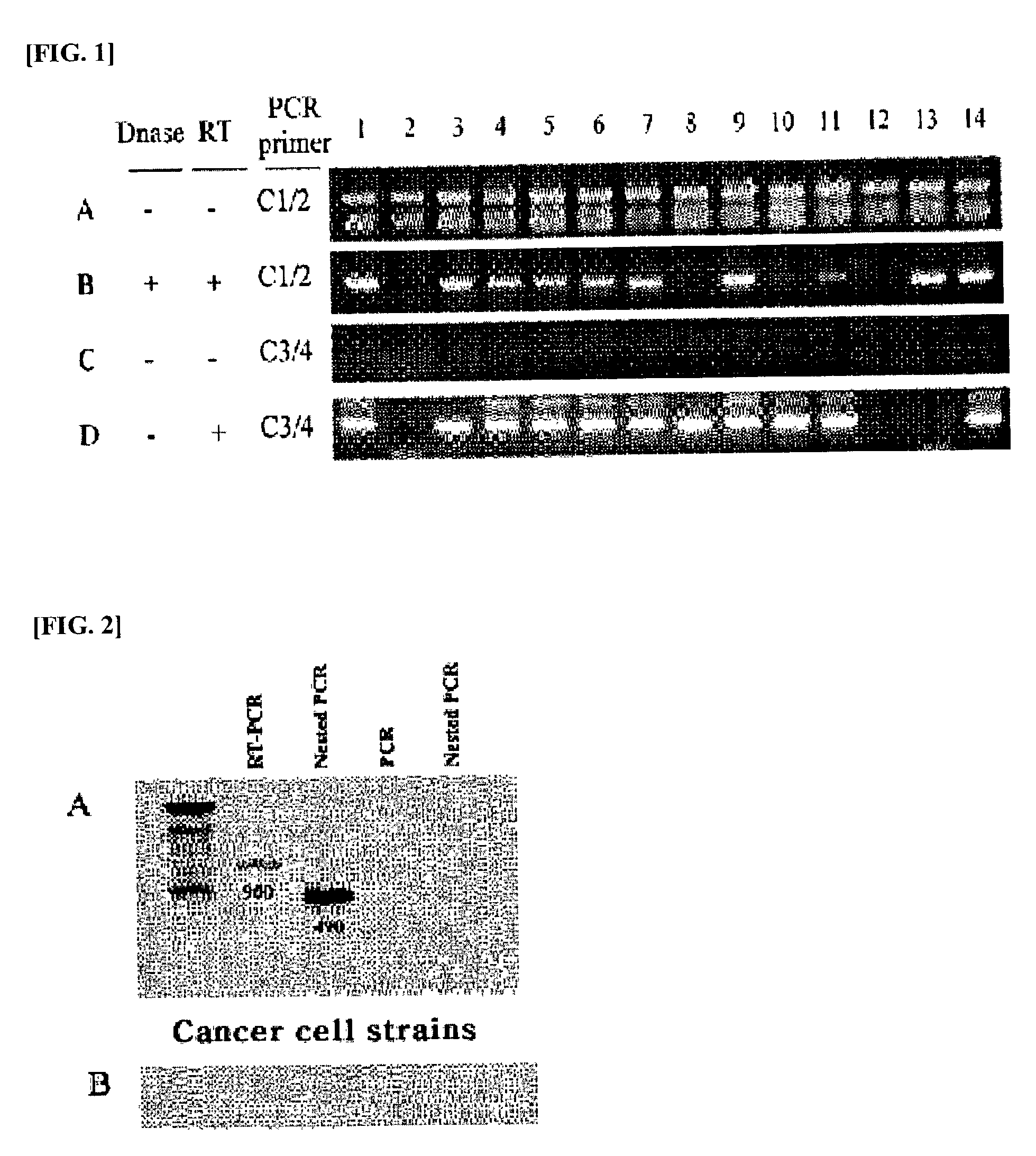 Selected primers for detection of MAGE or GAGE genes for diagnosis of cancer and methods of use