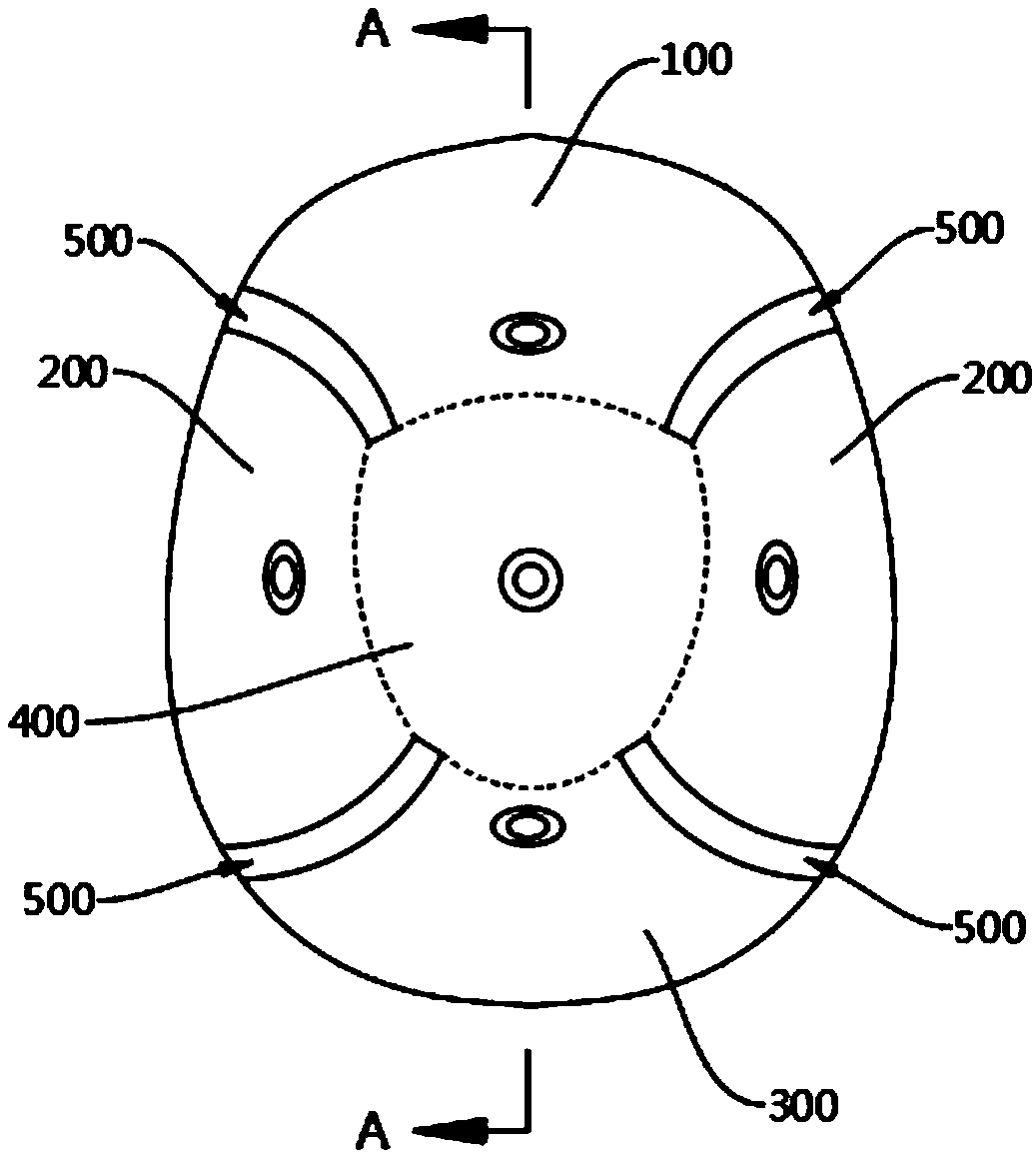 Incision compression fixator