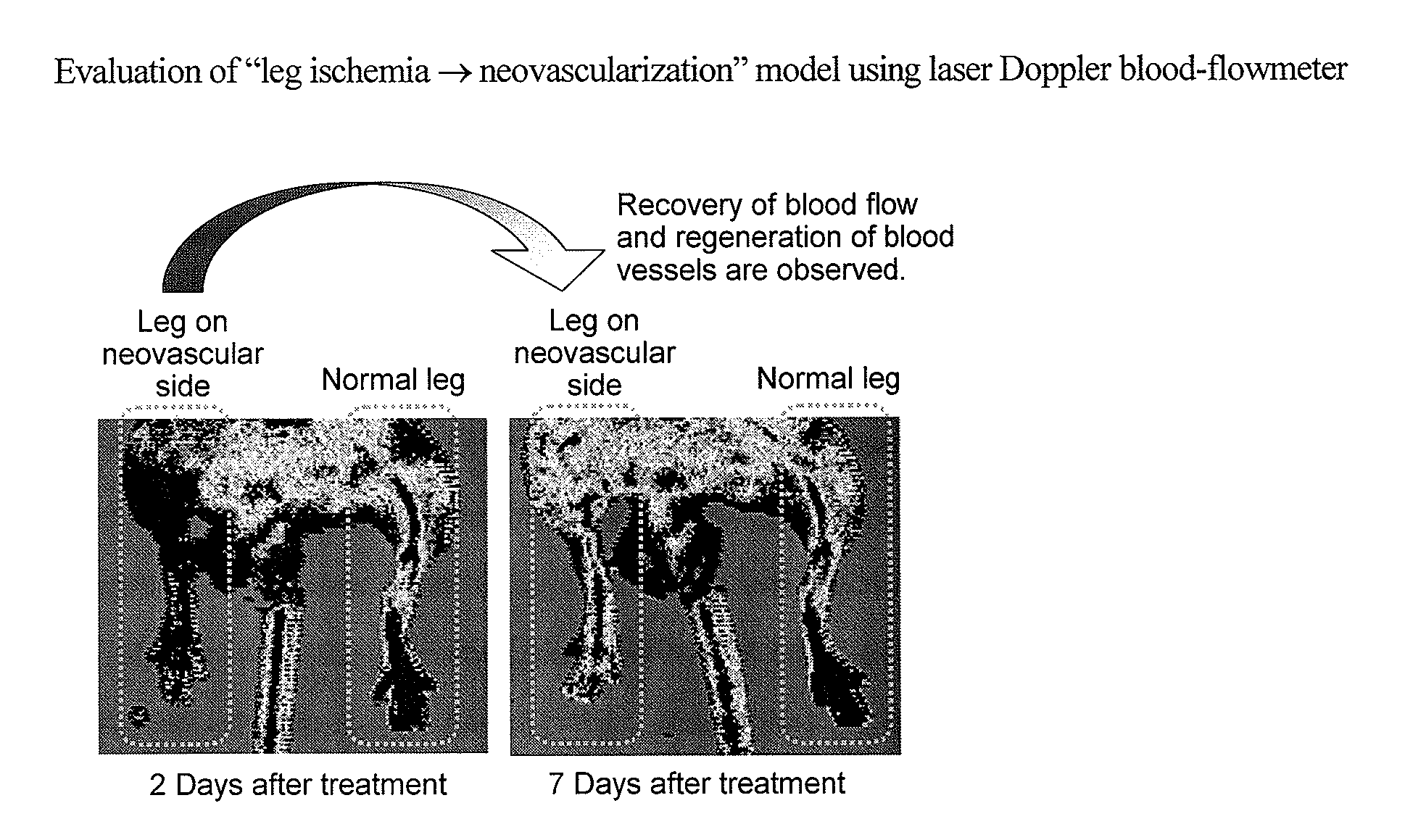 Targeting agent to newly formed blood vessels