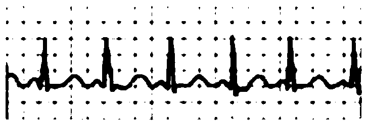 Display device with heart rate detection function and heart rate detection method