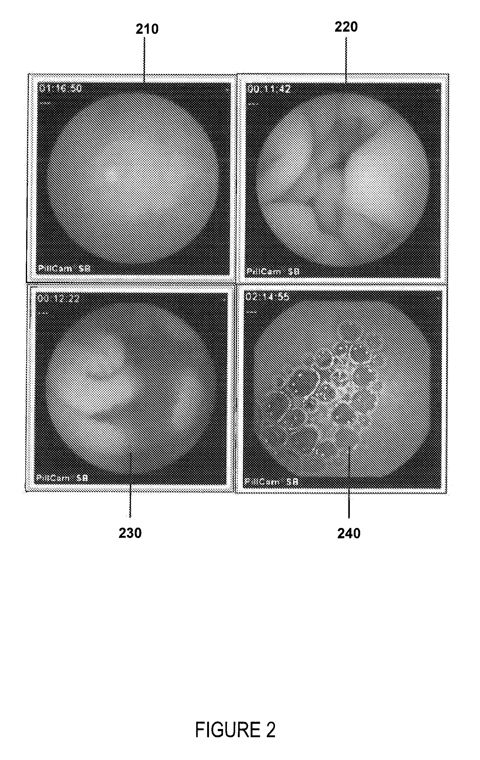 System and method for automated disease assessment in capsule endoscopy