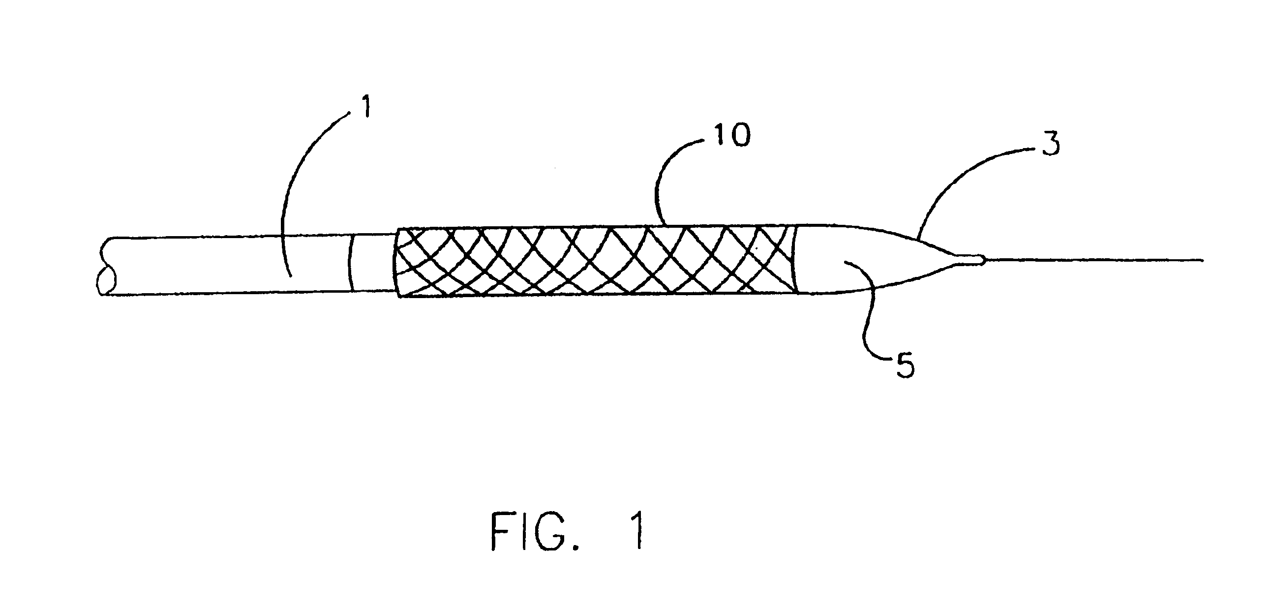 Endoprostheses and methods of manufacture