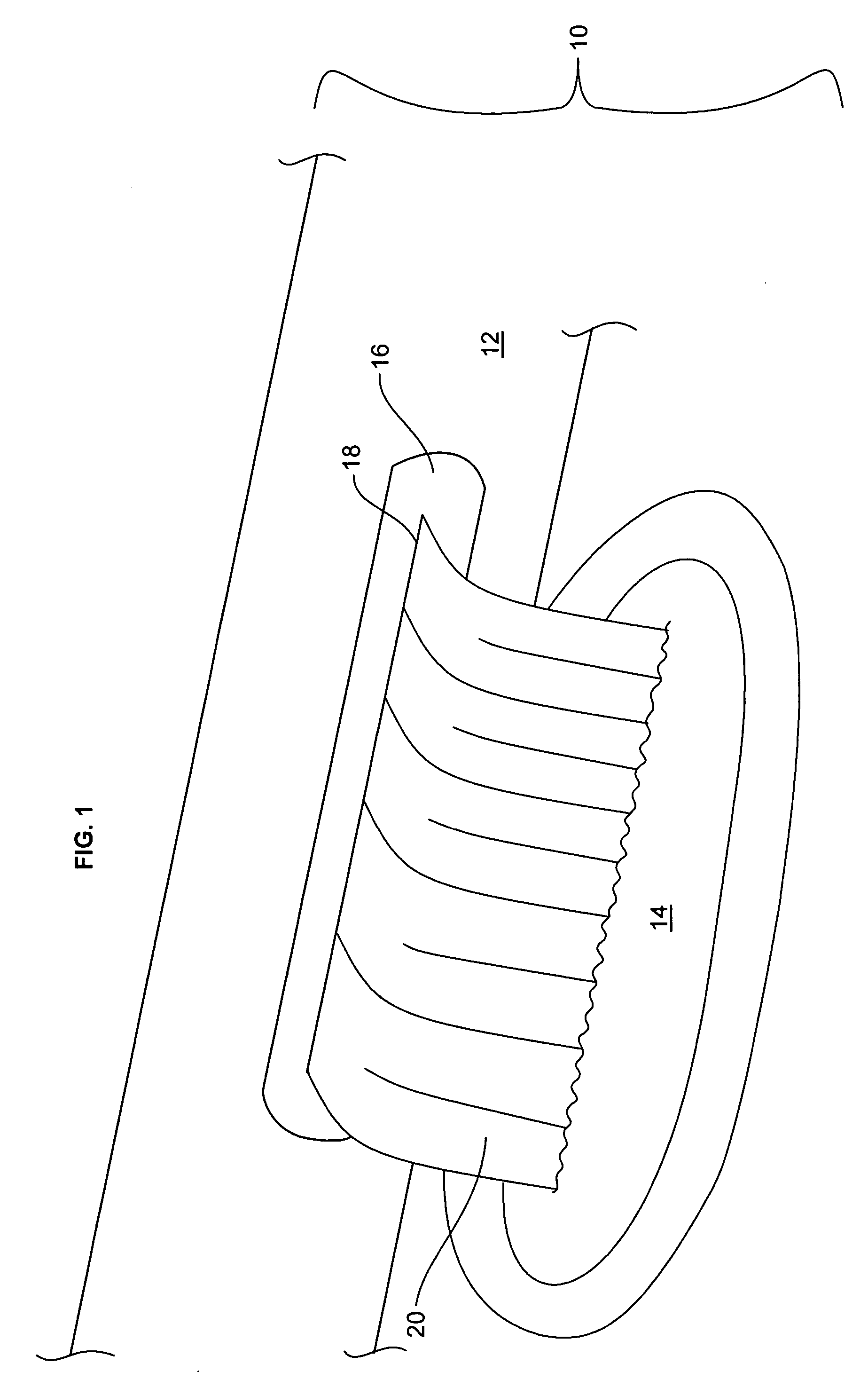Waterfall waterjet with debris removing outlet