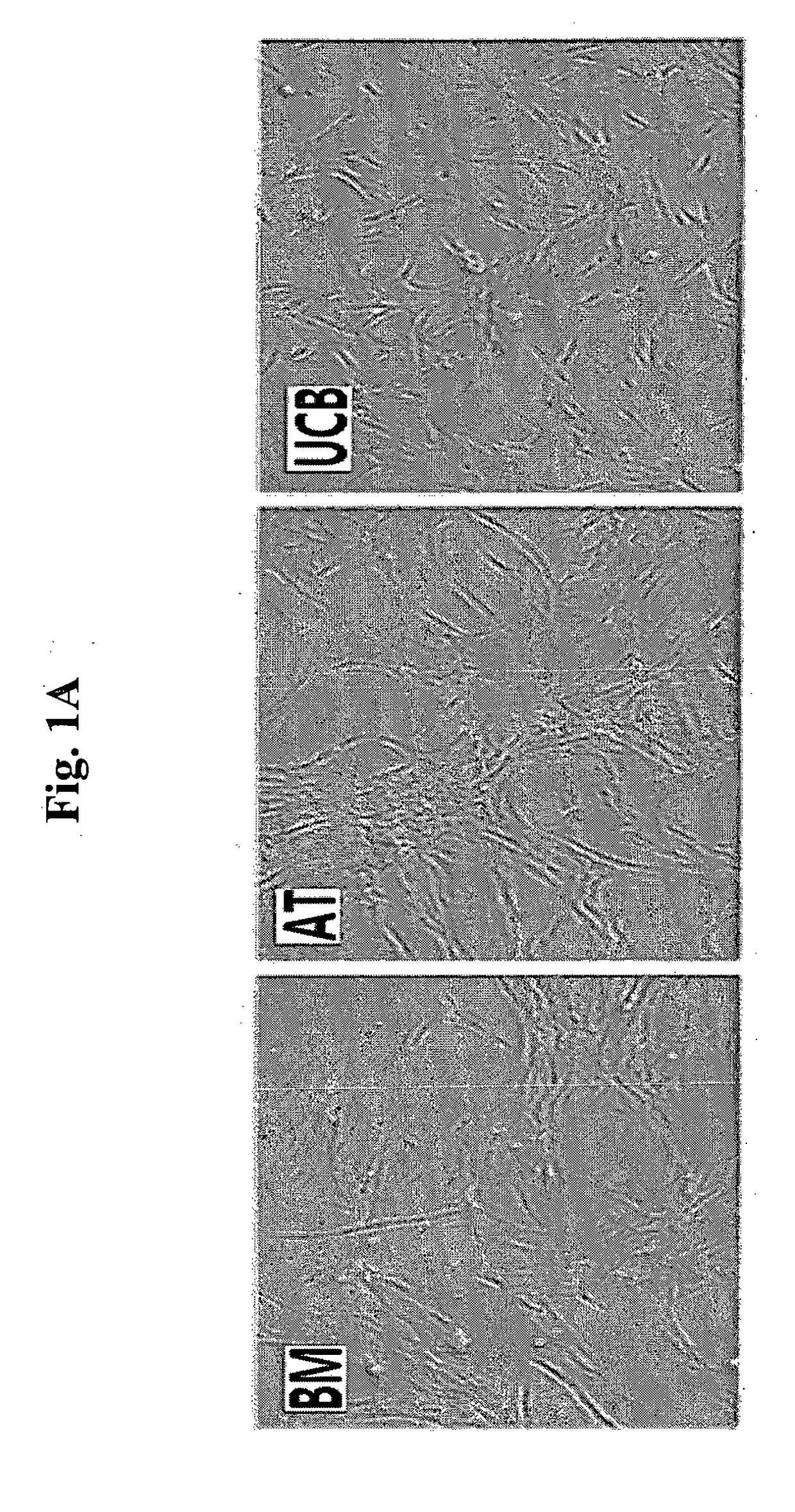 Pharmaceutical composition for the prevention or treatment of a pulmonary disorder comprising mesenchymal stem cells having improved proliferation and differentiation capacity