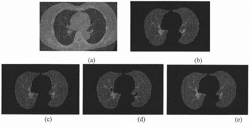 Three-dimensional image segmentation method based on three-dimensional improved pulse coupled neural network