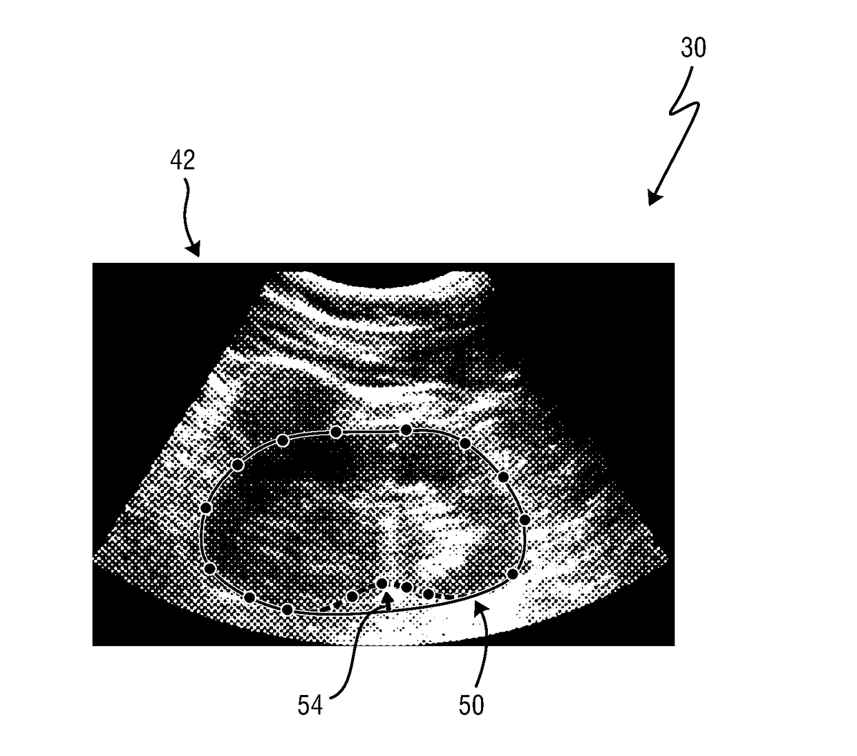 Ultrasound imaging apparatus and method for segmenting anatomical objects