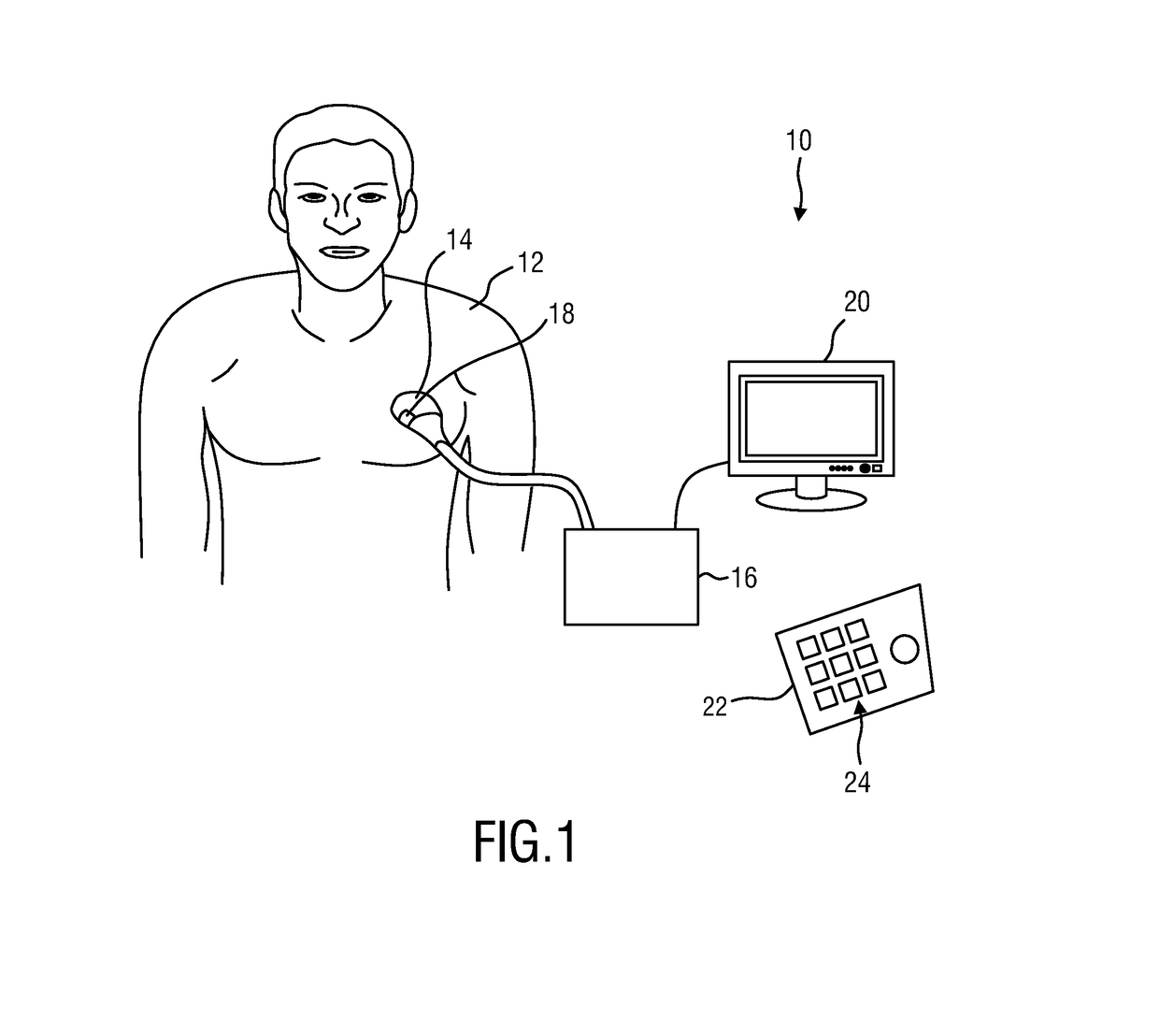 Ultrasound imaging apparatus and method for segmenting anatomical objects