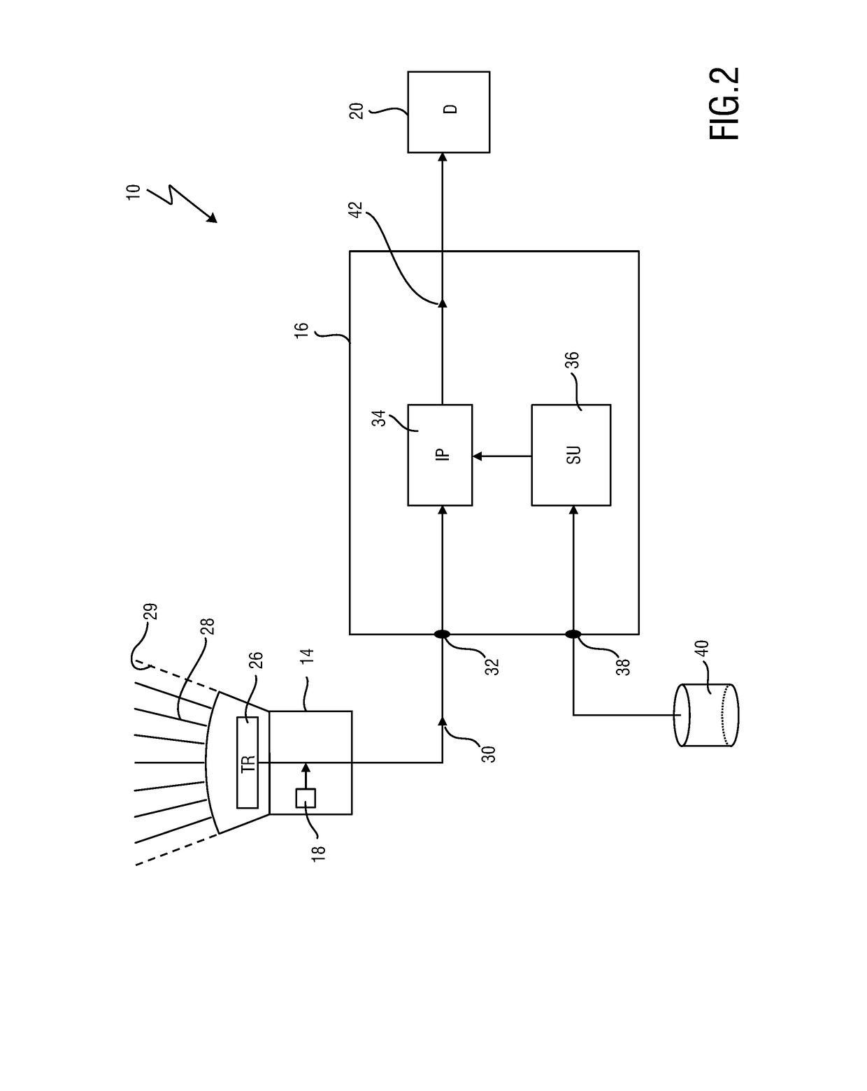 Ultrasound imaging apparatus and method for segmenting anatomical objects