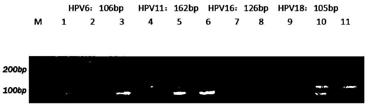 Kit and method for HPV (human papillomavirus) parting detection