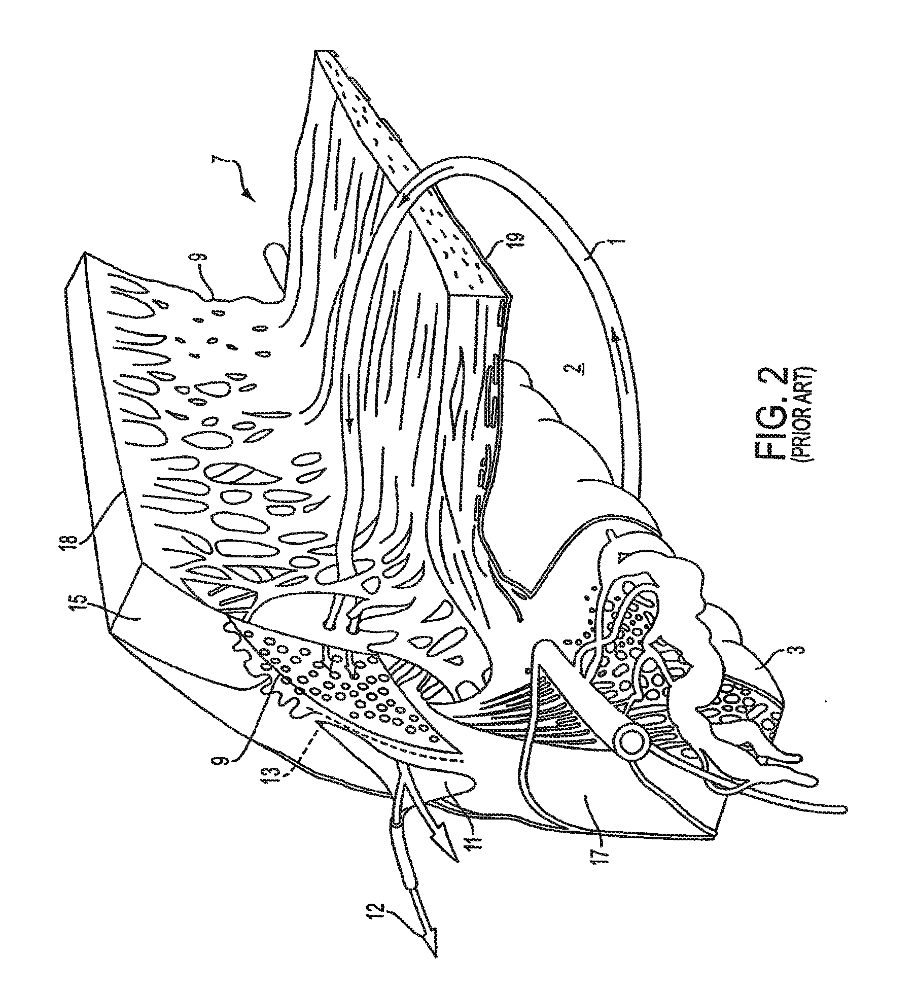 Delivery System and Method of Use for the Eye