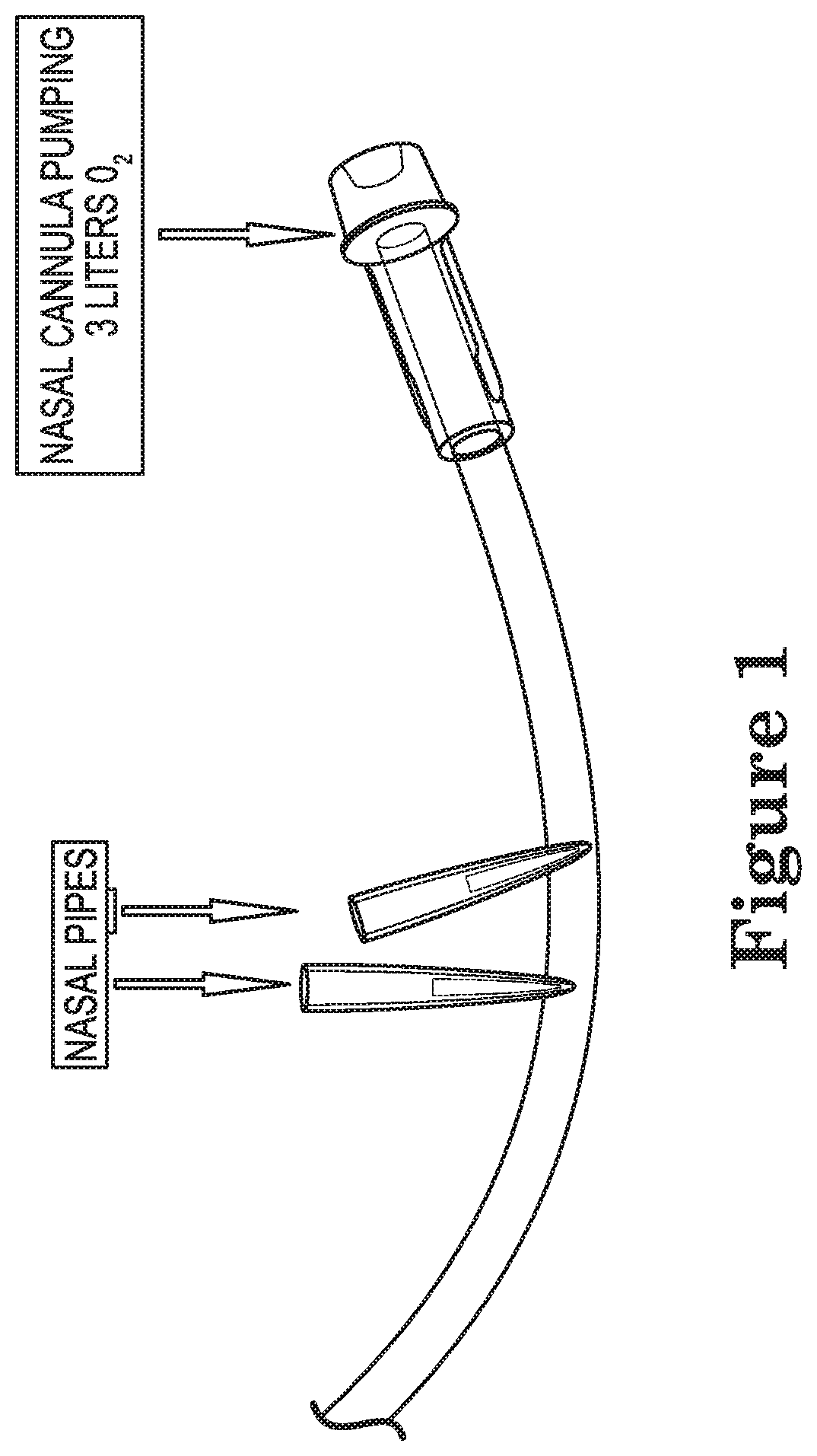 High flow of warm humidified oxygen