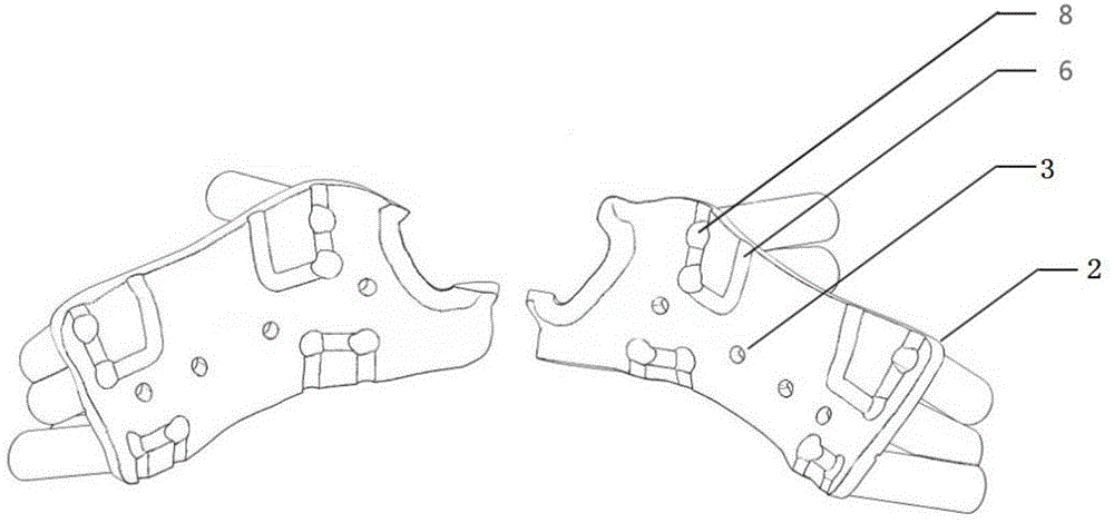 Upper jaw Le Fort I type osteotomy operation guide plate and design method thereof