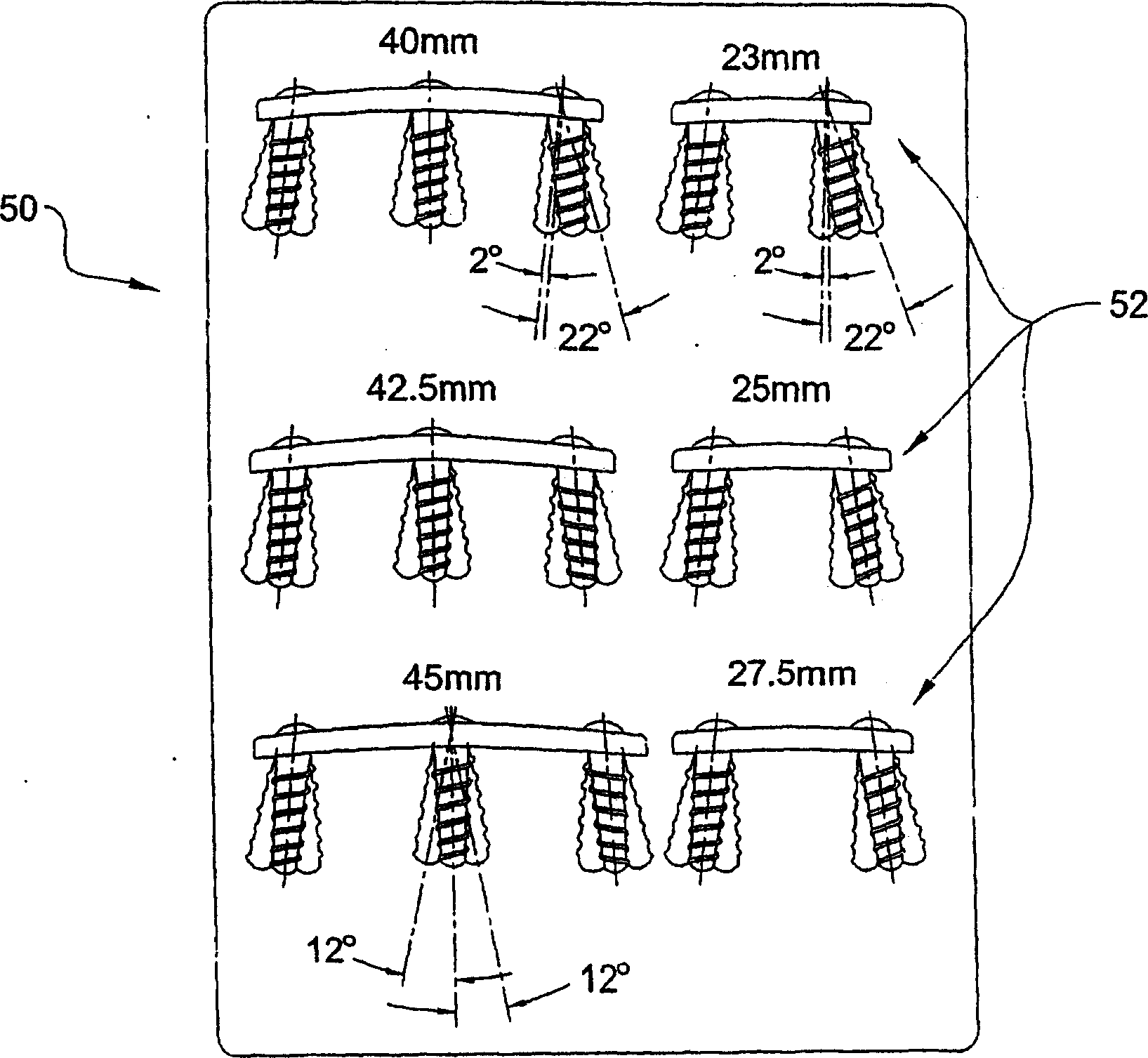 Surgical kit and method for providing sterilized equipment for use in spinal surgery