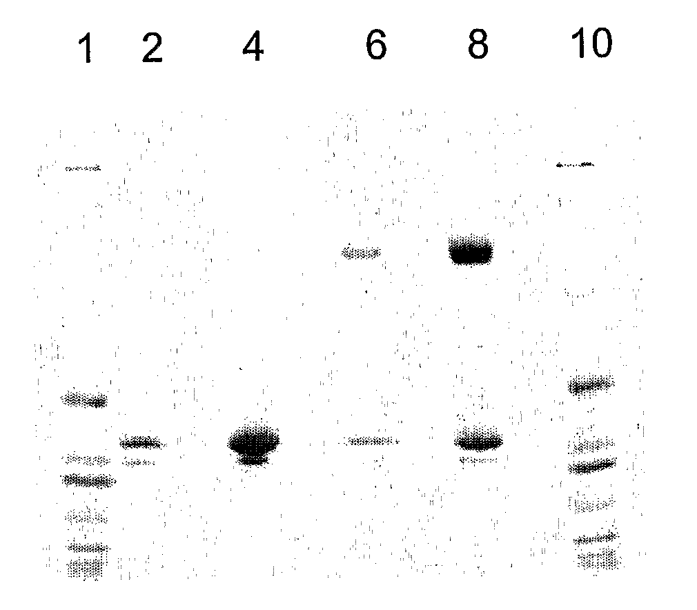 Method to Reduce Oxalate Concentration by Administration of Oxalate Oxidase Crystals