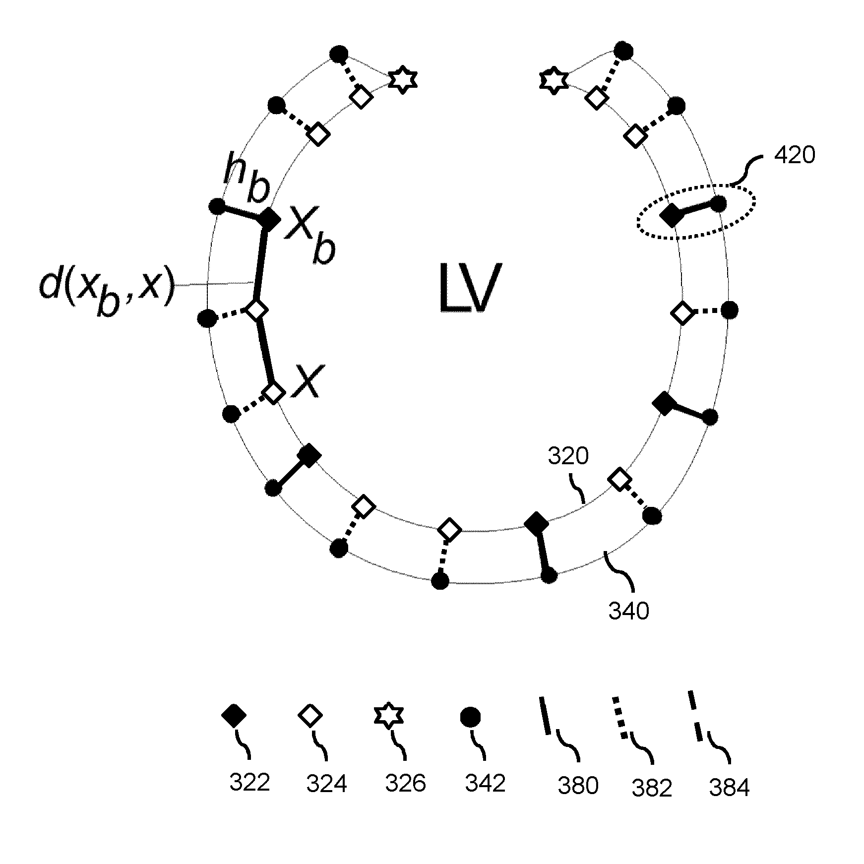 Model-based segmentation of an anatomical structure