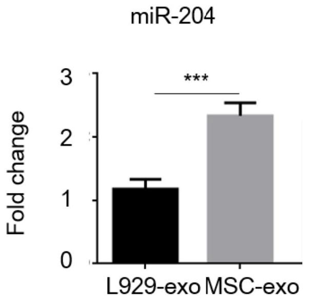 Exosome containing miR-204 and preparation method and application of exosome