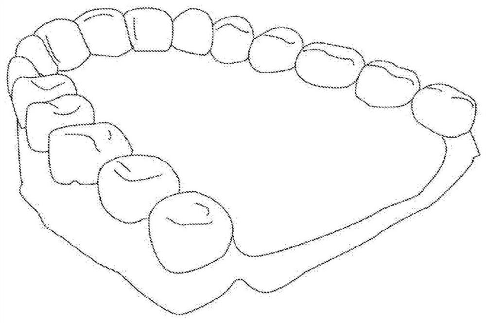 Elastic orthodontic appliance