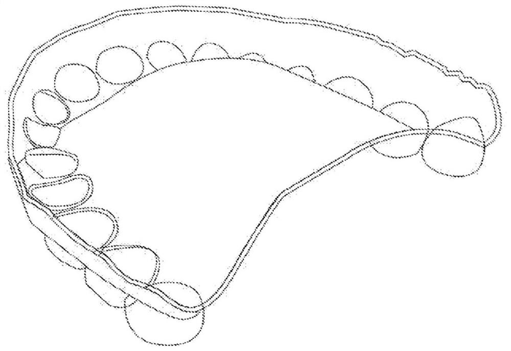 Elastic orthodontic appliance