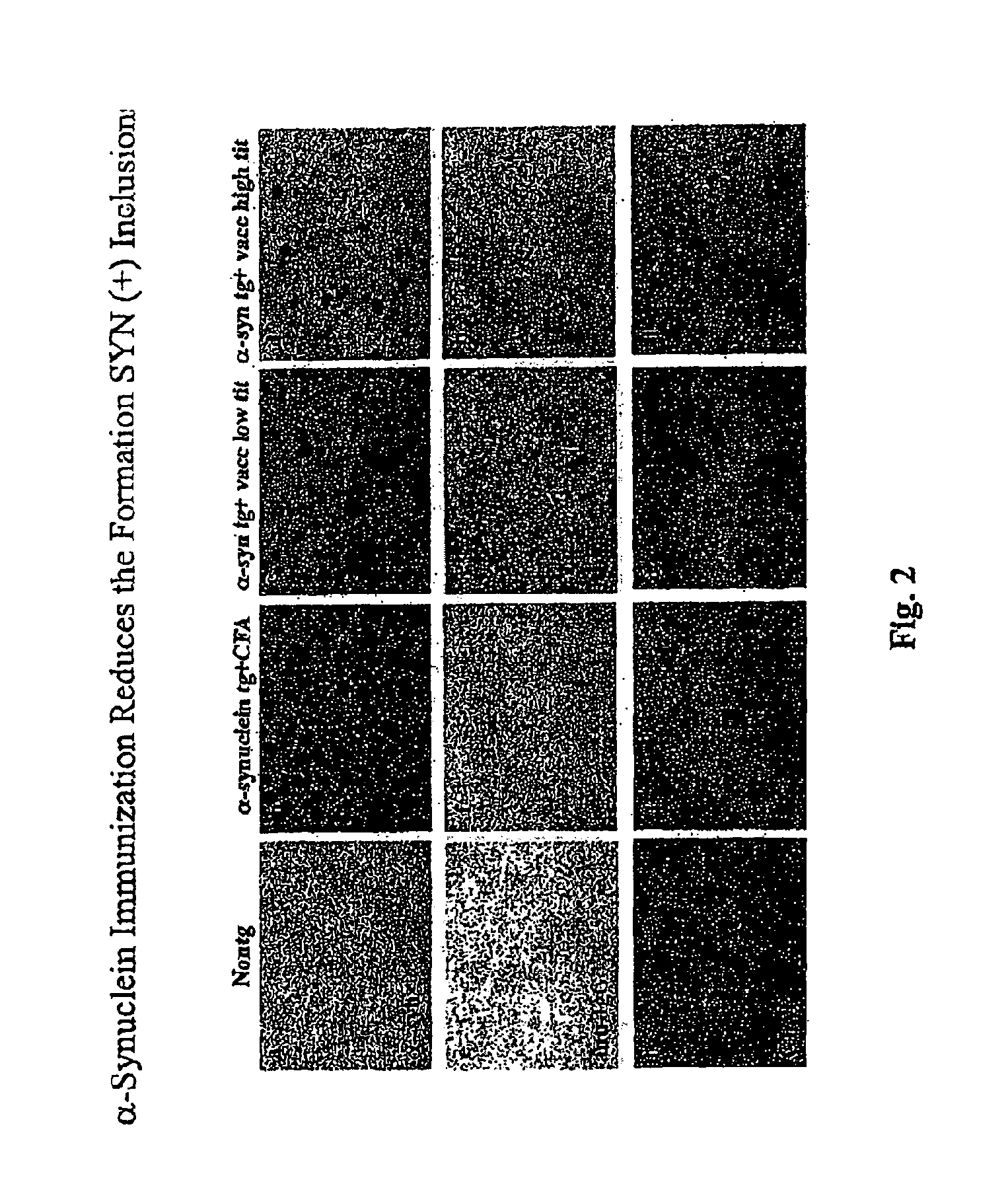 Prevention and Treatment of Synucleinopathic and Amyloidogenic Disease