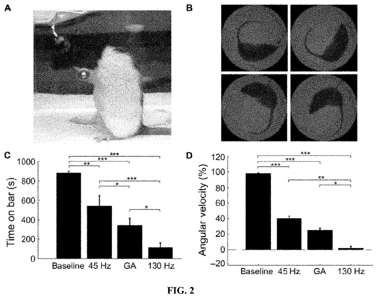 Method to design temporal patterns of nervous system stimulation