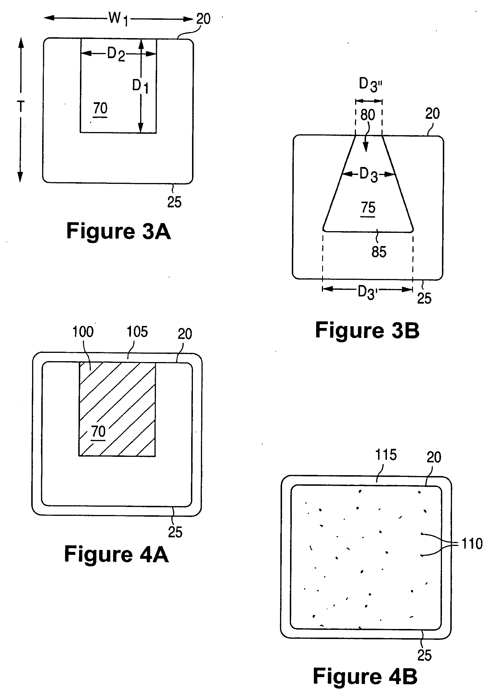 Anti-Proliferative and Anti-Inflammatory Agent Combination for Treatment of Vascular Disorders with an Implantable Medical Device