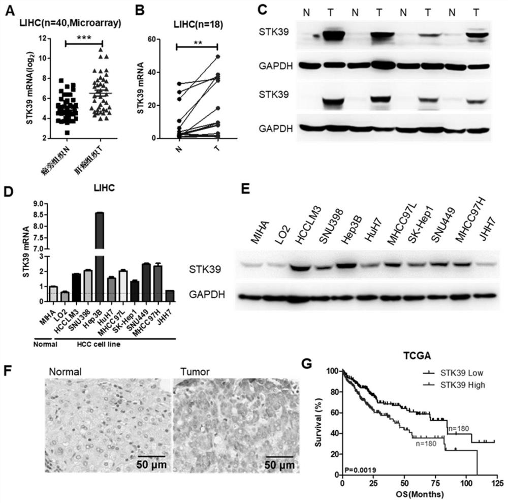 Application of liver cancer diagnosis and treatment oncogenic kinase marker