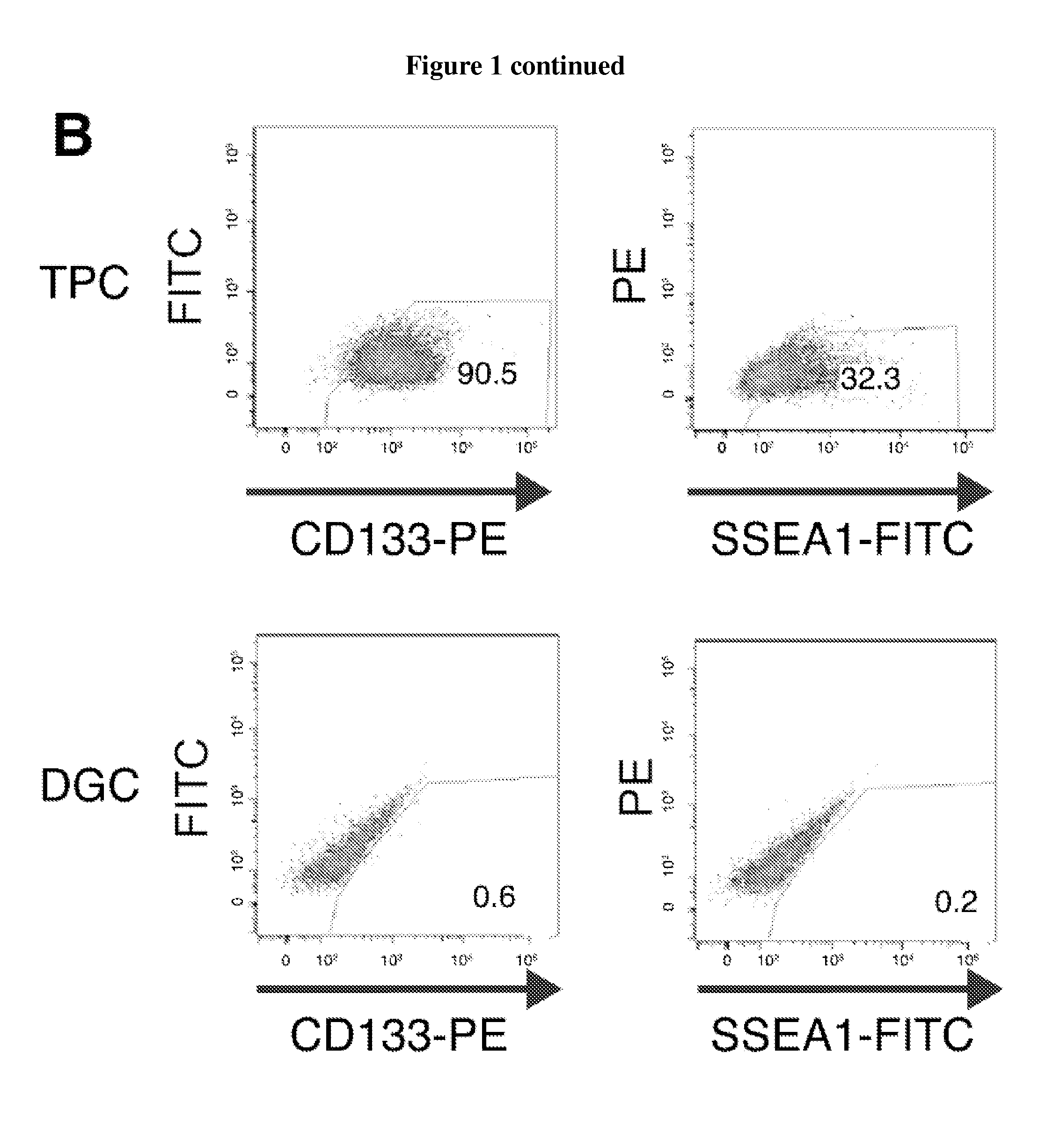 Compositions and methods for detecting and treating glioblastoma