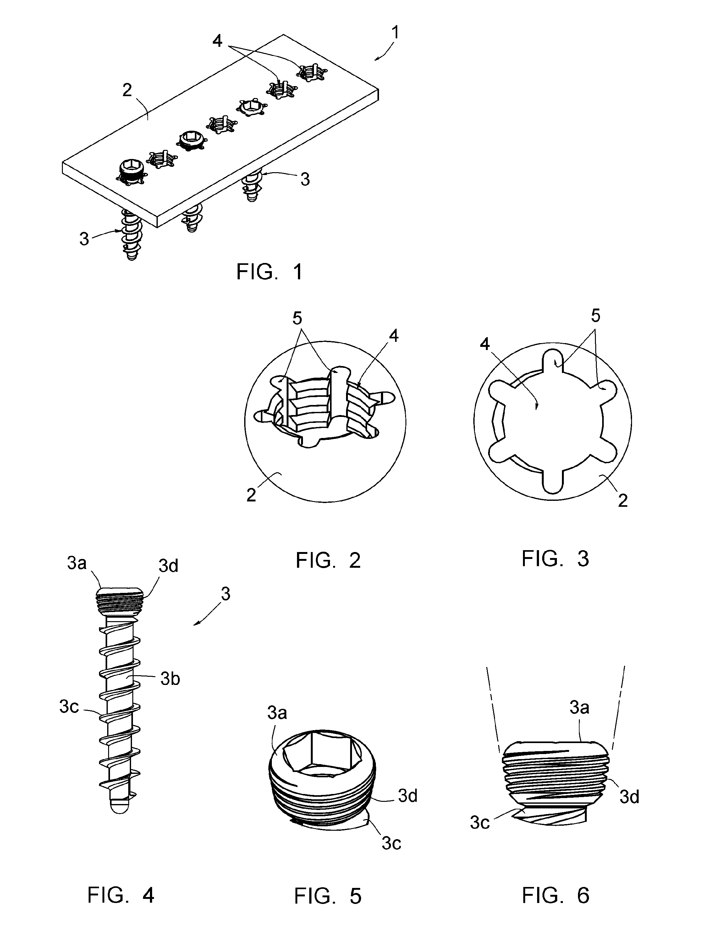 Assembly comprising an implantable part designed to be fastened to one or more bones or bone portions to be joined, and at least one screw for fastening the implantable part to said bone(s)
