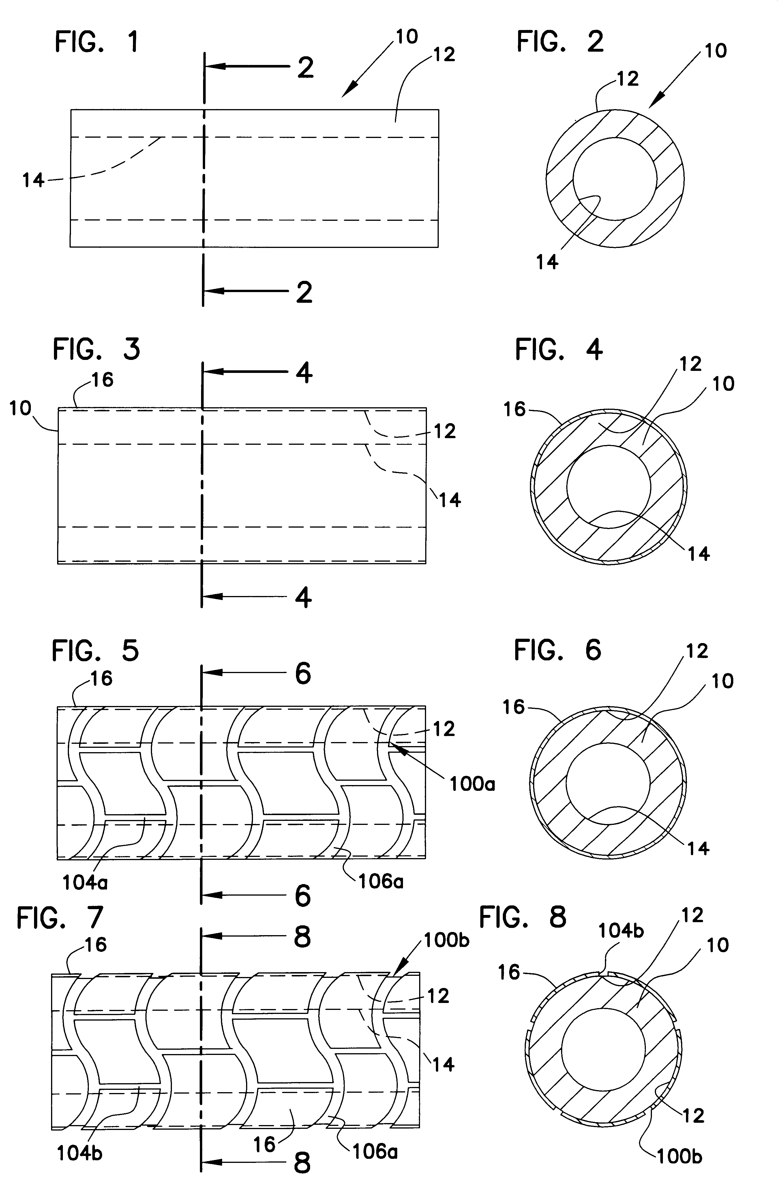 Method for manufacturing intraluminal device