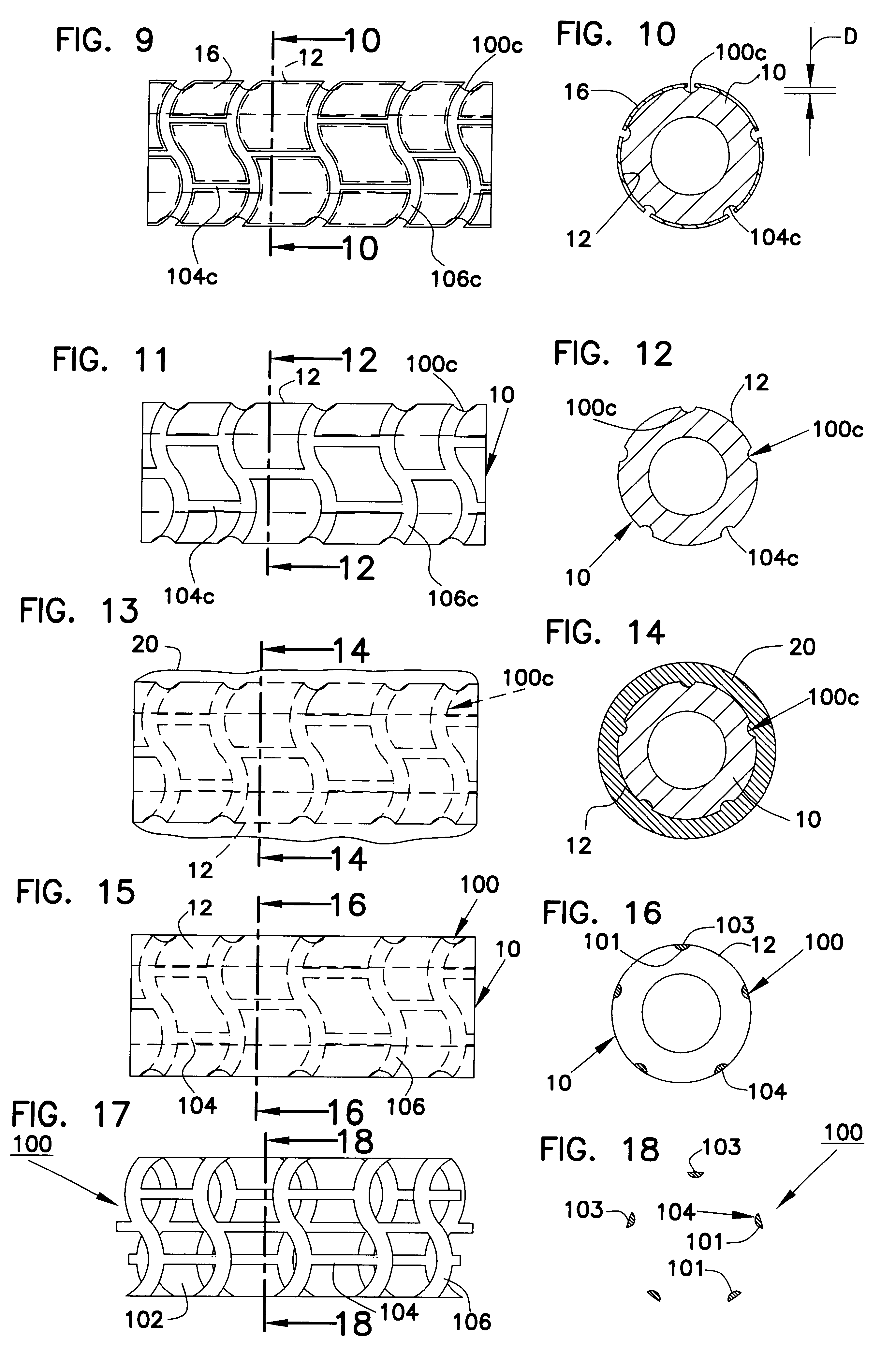 Method for manufacturing intraluminal device