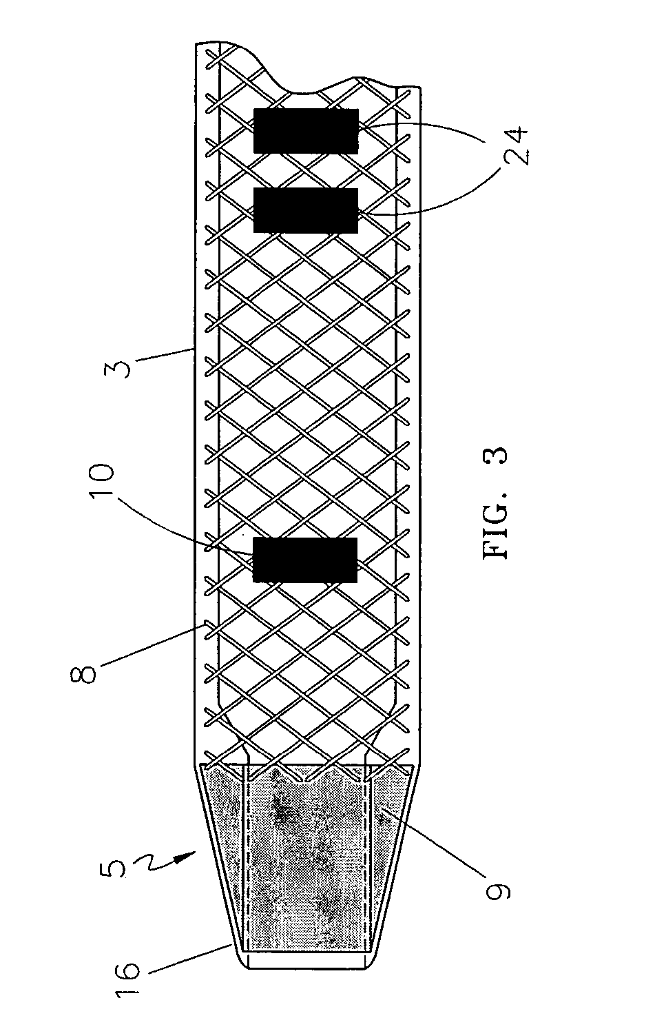 Endovascular treatment apparatus and method