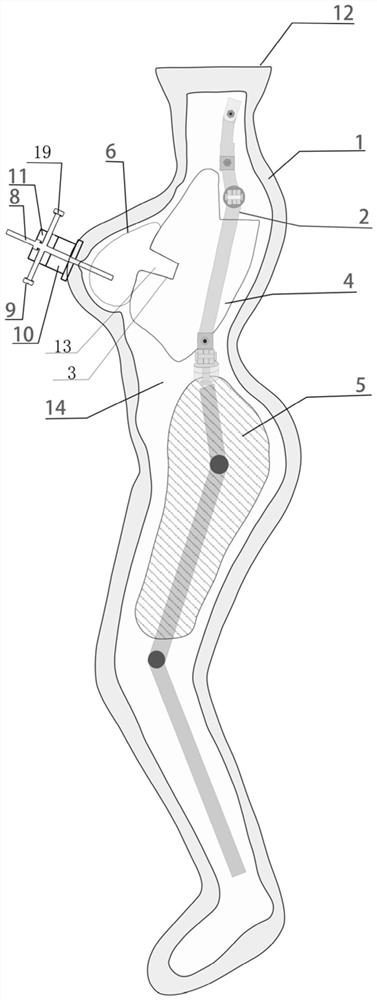 Manufacturing method for breast imitated soft tissue filling