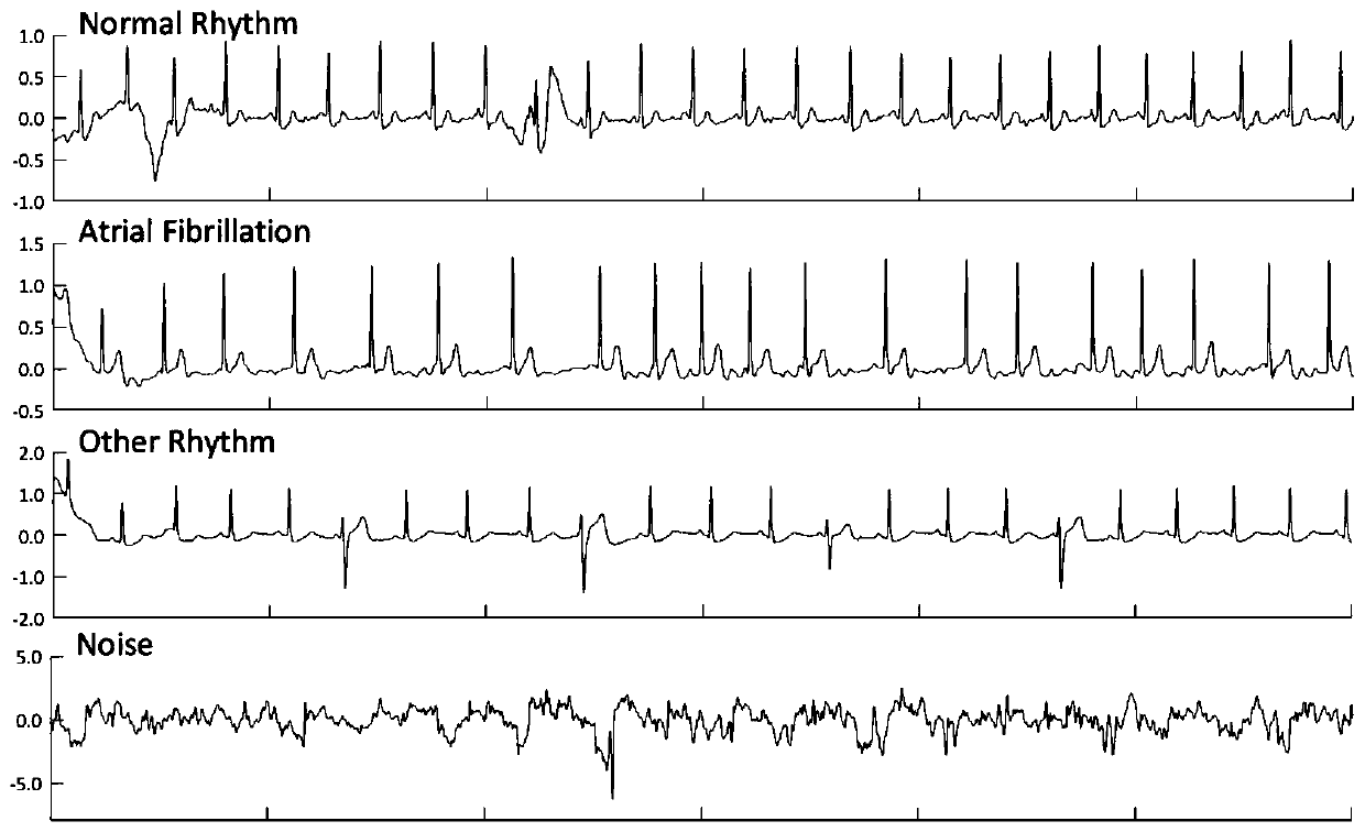 Arhythmia testing method for aiming at electrocardiogram data by means of binary neural network