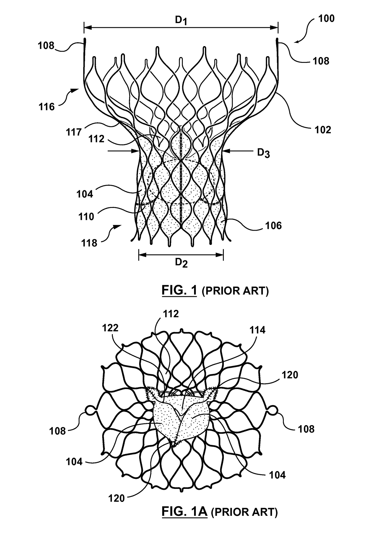 Filtered sealing components for a transcatheter valve prosthesis