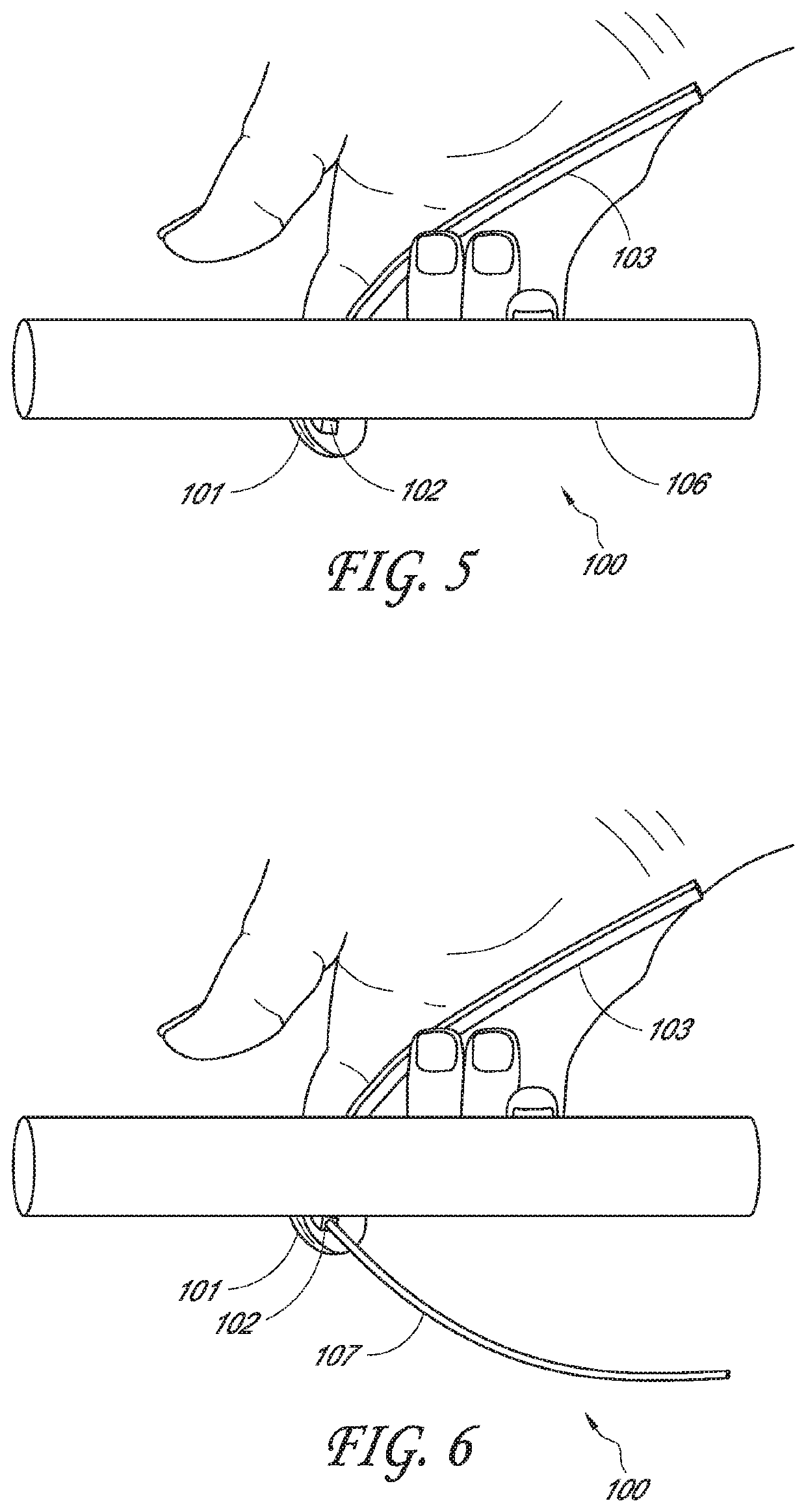 Tactile cerclage wire and cable passer and methods of use