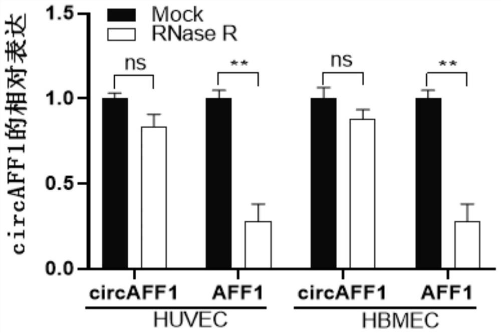 circRNA AFF1 and application thereof