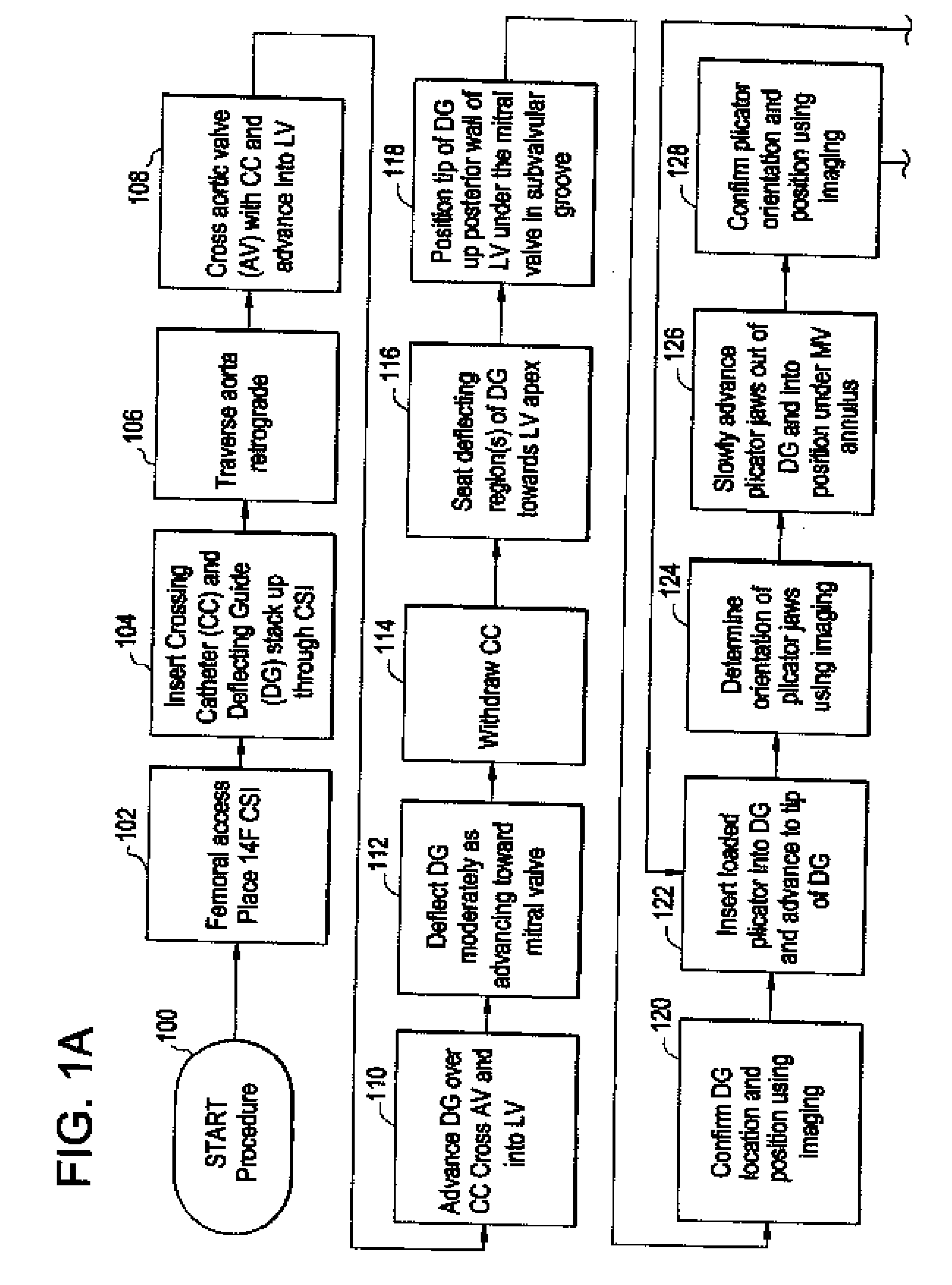 System using a helical retainer in the direct plication annuloplasty treatment of mitral valve regurgitation