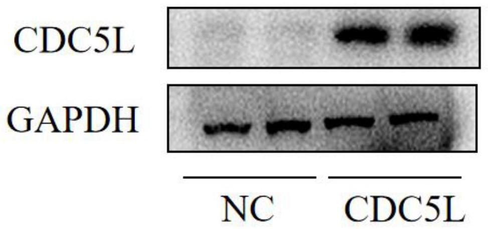 Recombinant human CDC5L fusion protein hydrogel, preparation method and application