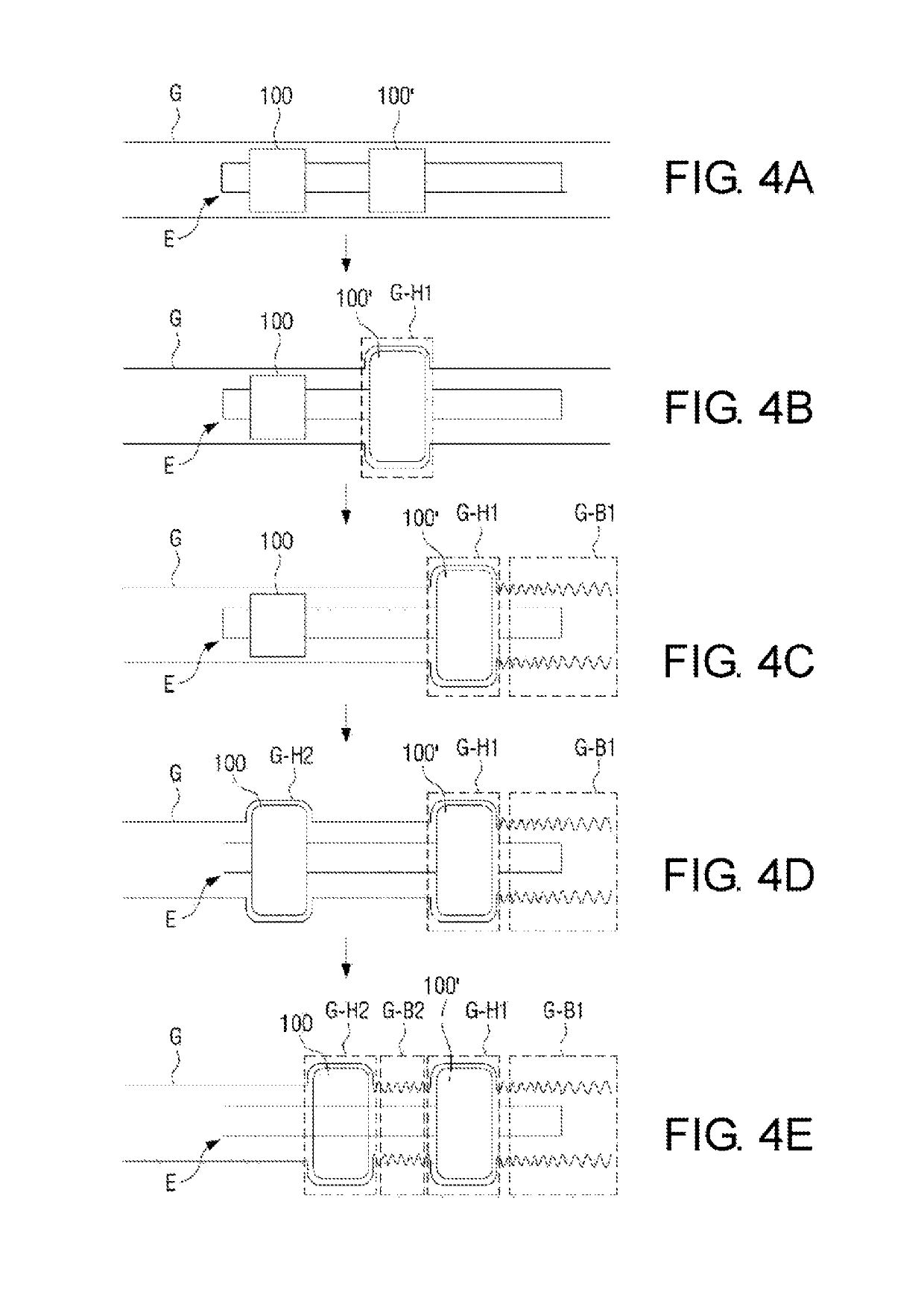 Apparatus and method for fixing and shortening bowel at the time of endoscopy