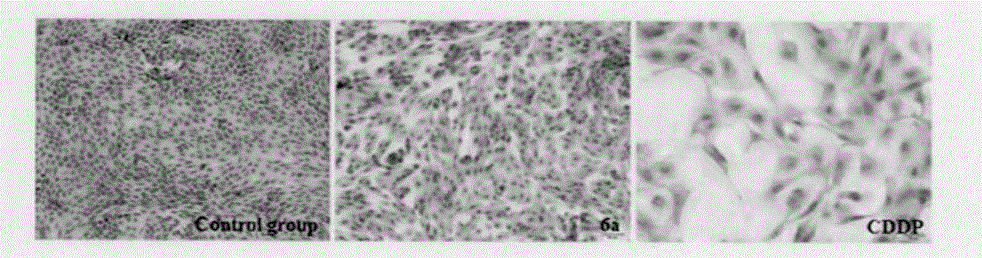 Preparation method and application of antitumor drug X-TOA