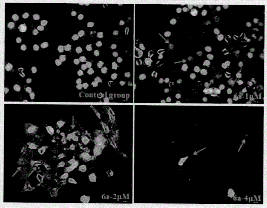 Preparation method and application of antitumor drug X-TOA