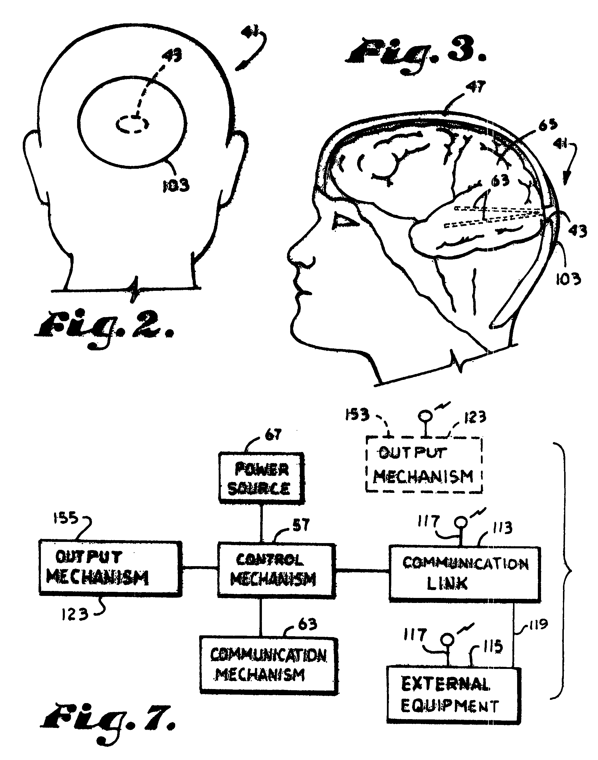 Bi-directional cerebral interface system