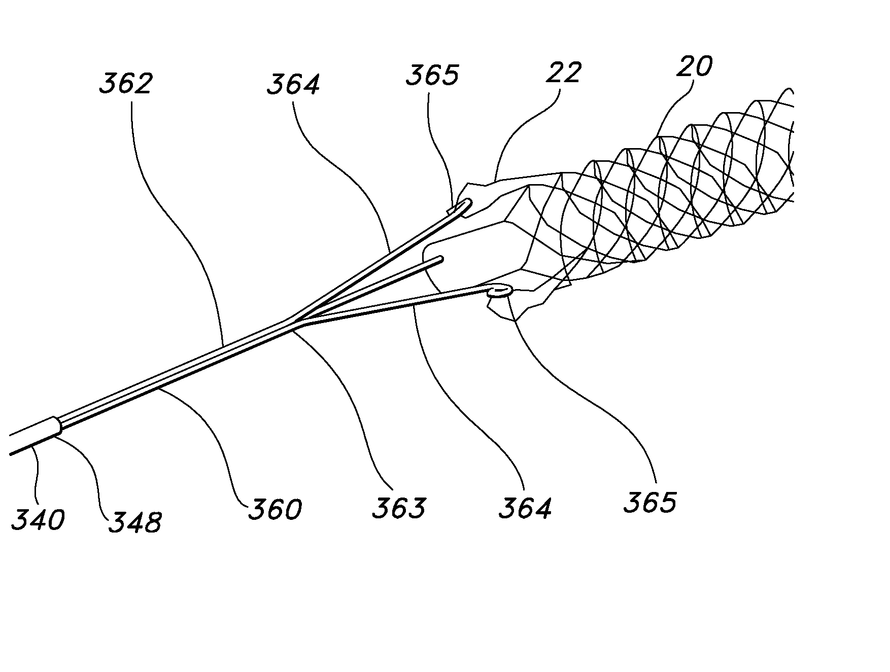 Intraluminary stent relocating apparatus