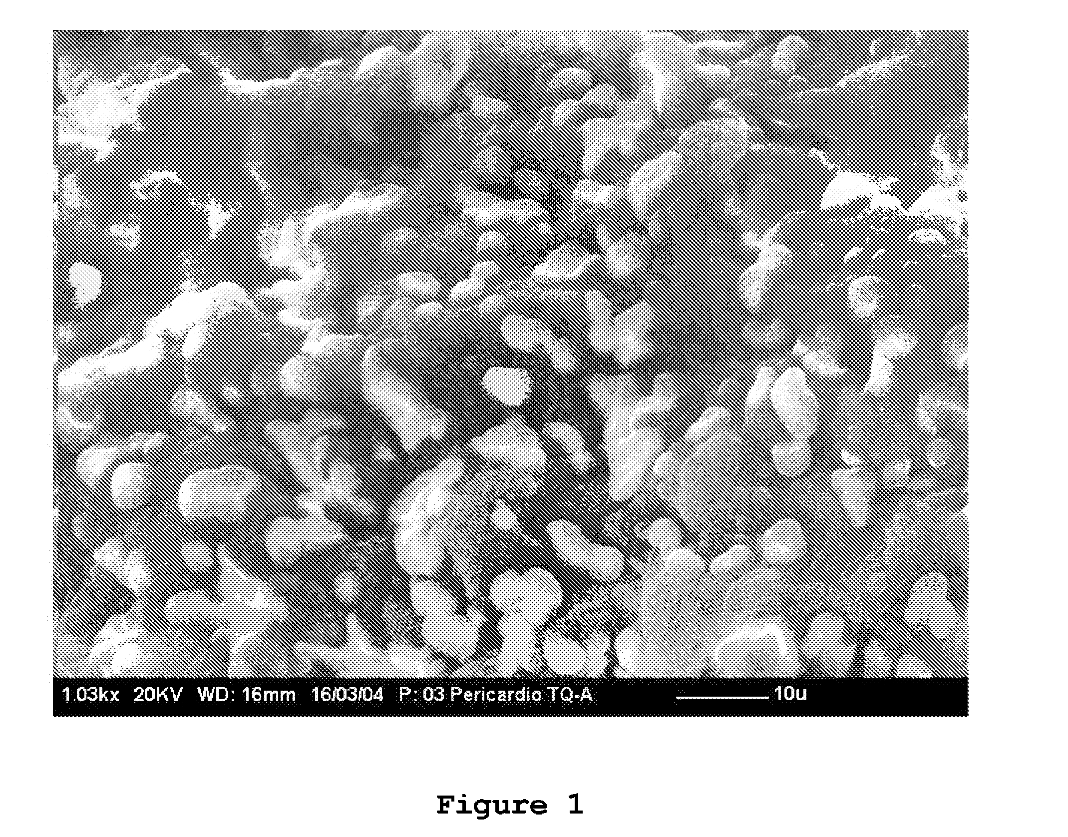 Method of preparing acellularized, biocompatible, implantable material