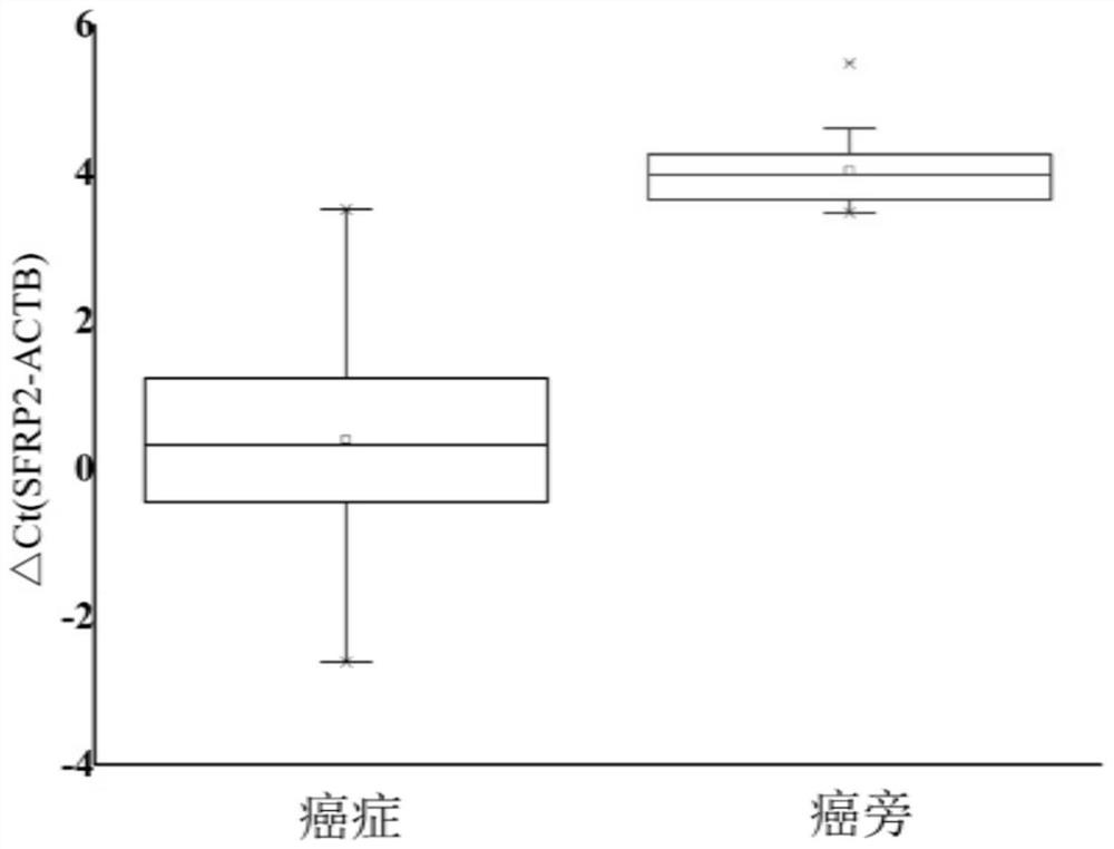 A primer and probe set for gastrointestinal cancer diagnosis, detection or screening