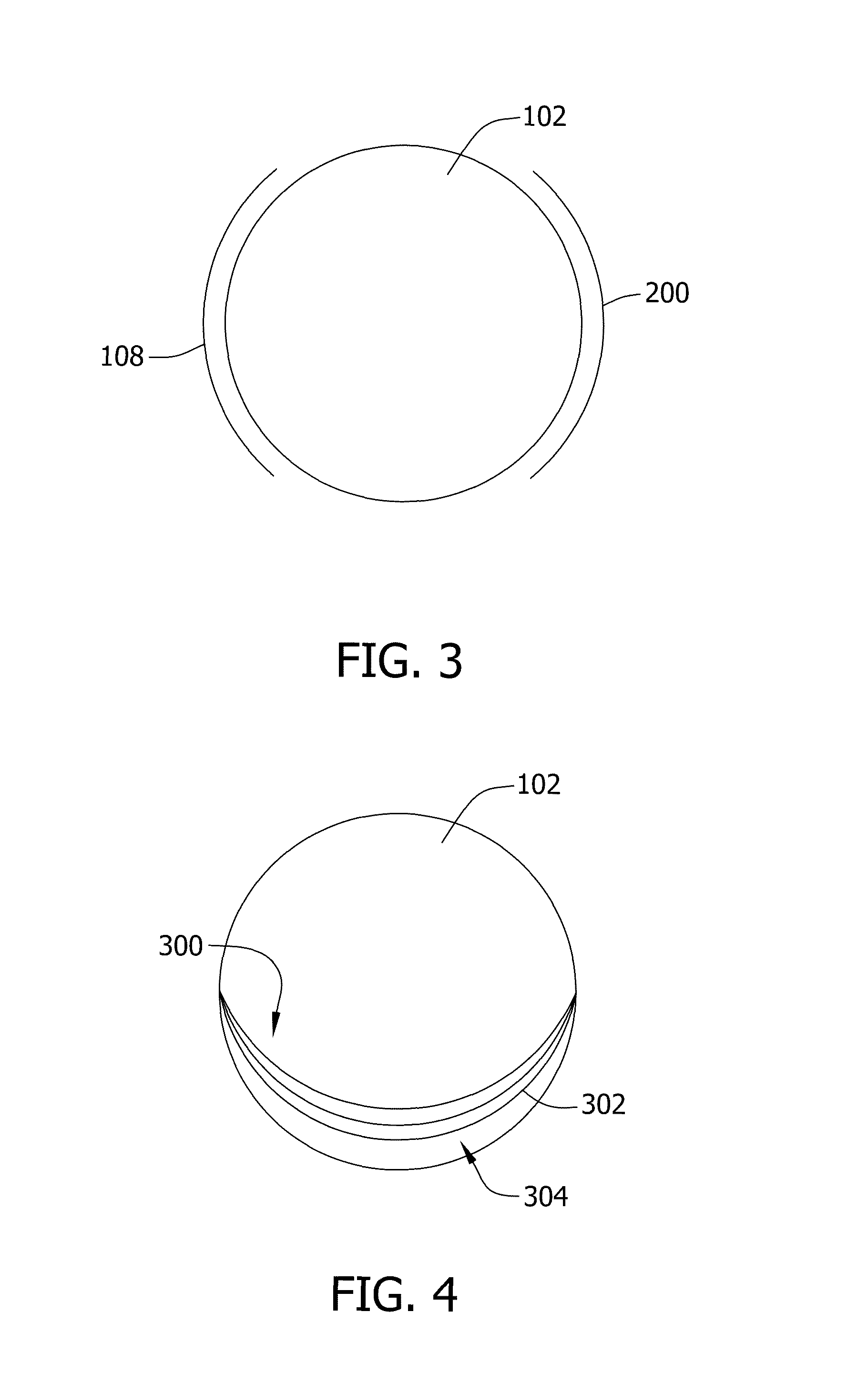 Method and apparatus for expanding tissue
