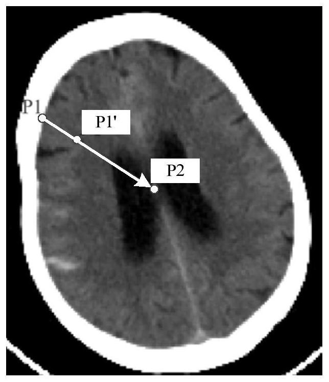 Medical image-based bleeding area detection method and device, and storage medium